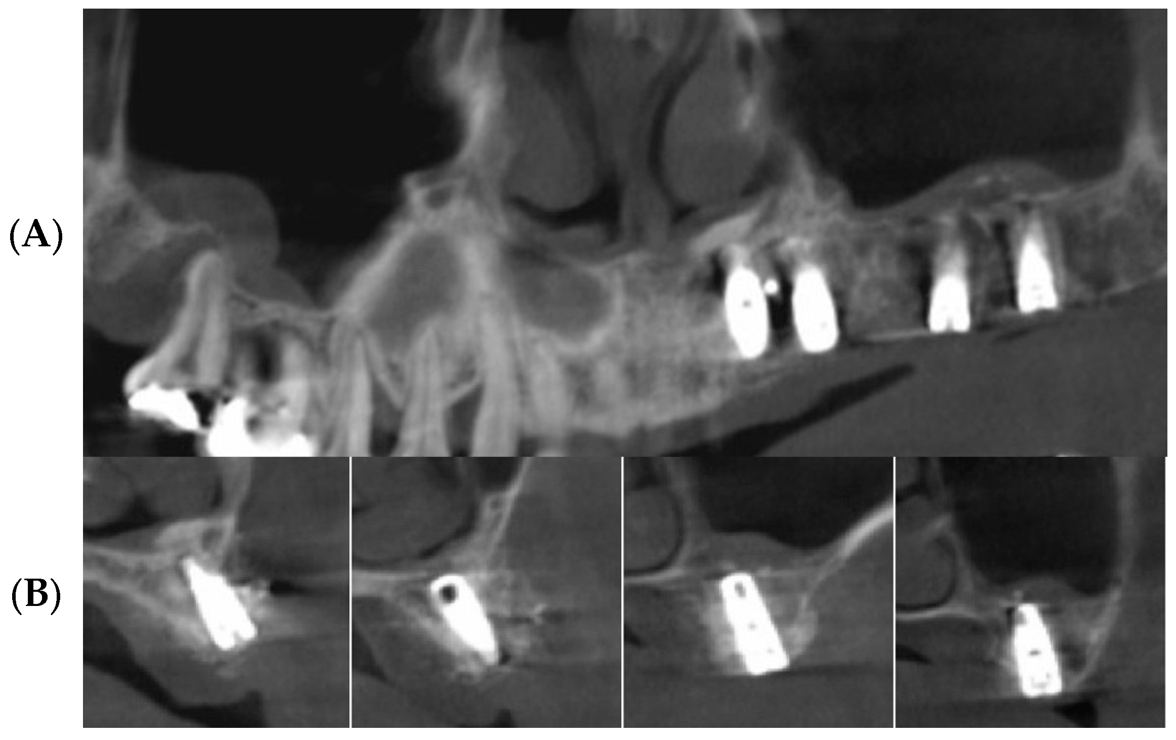 Bioengineering 11 00633 g008