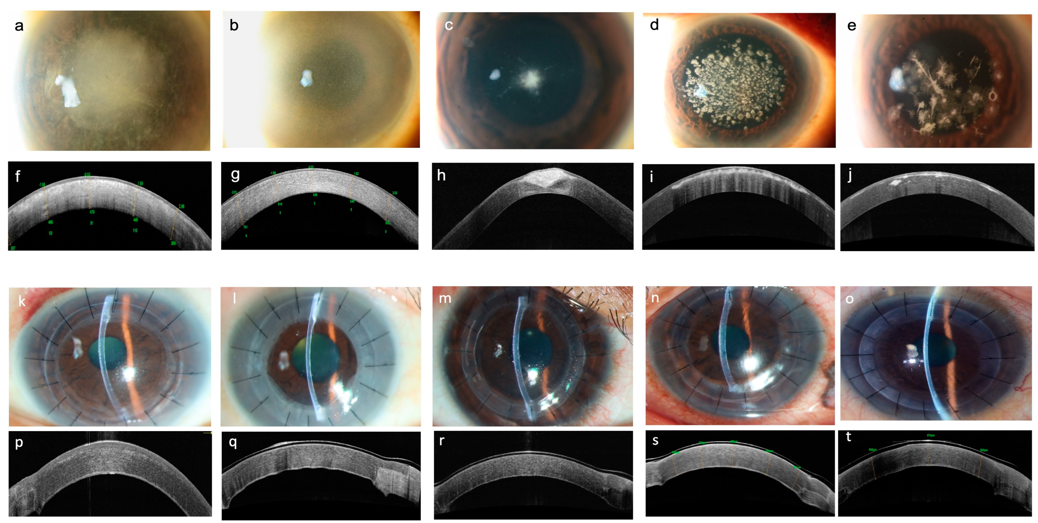 Bioengineering 11 00639 g004