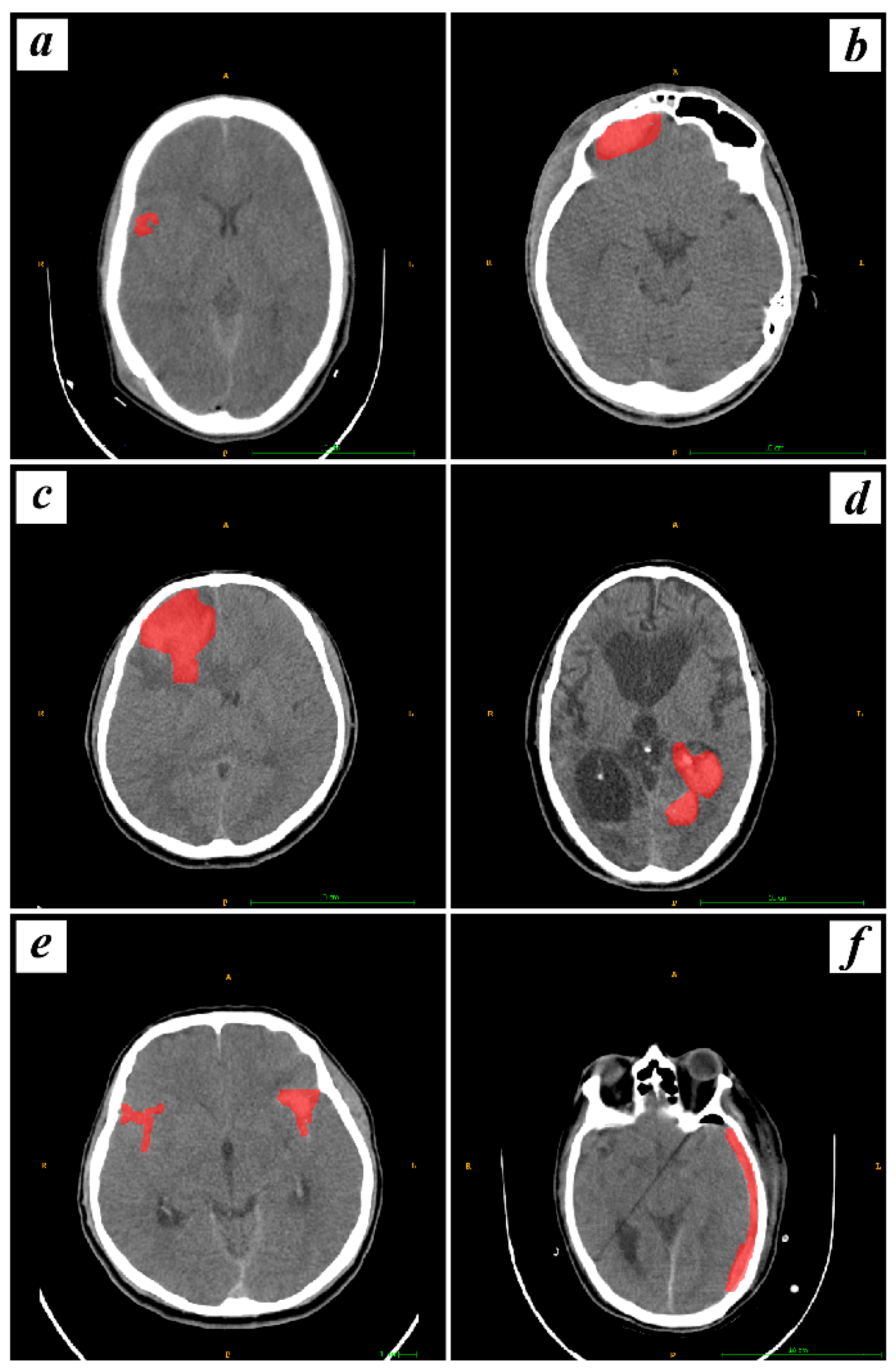 Bioengineering 11 00643 g002