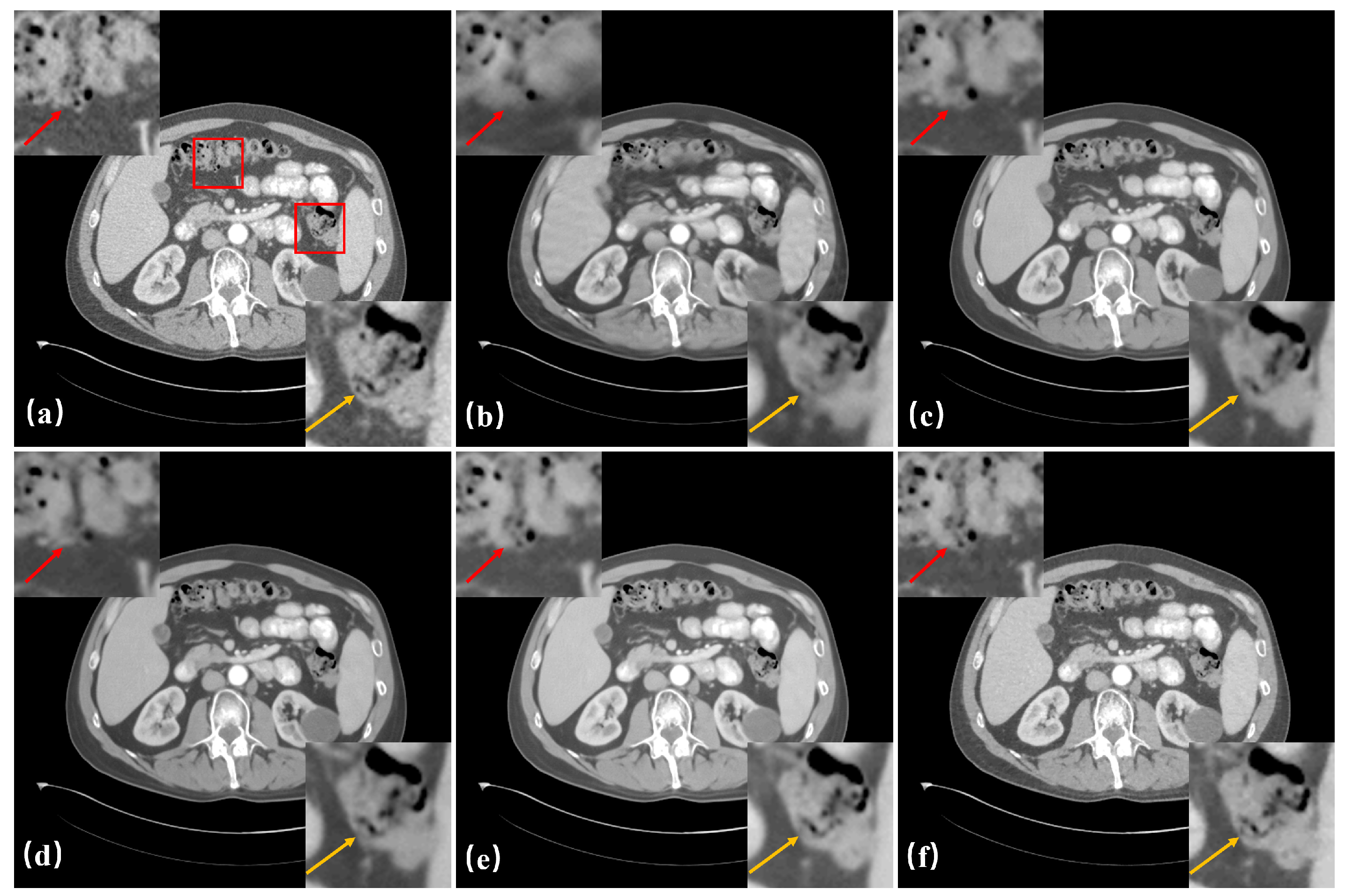 Bioengineering 11 00646 g008
