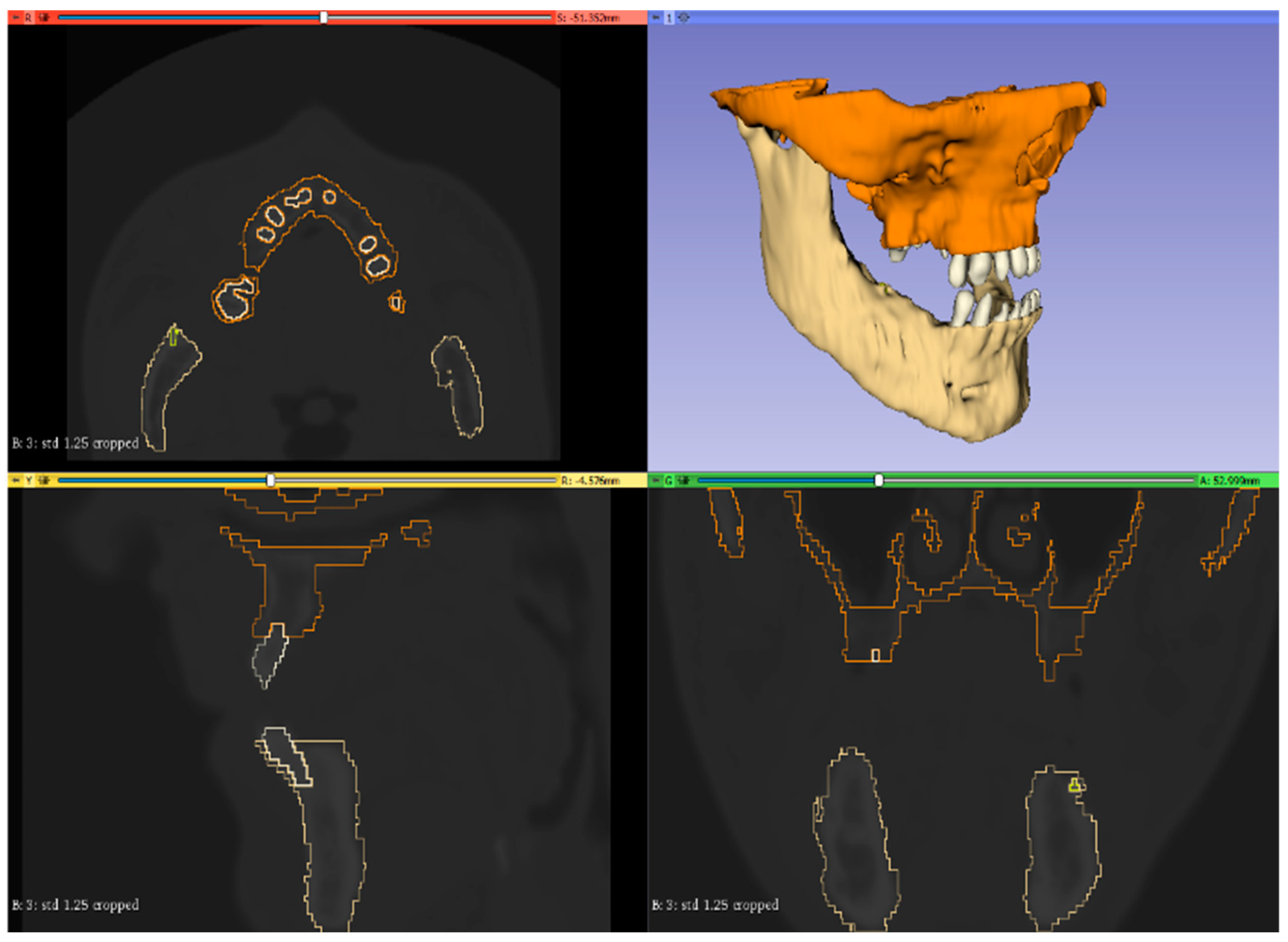Bioengineering 11 00668 g002