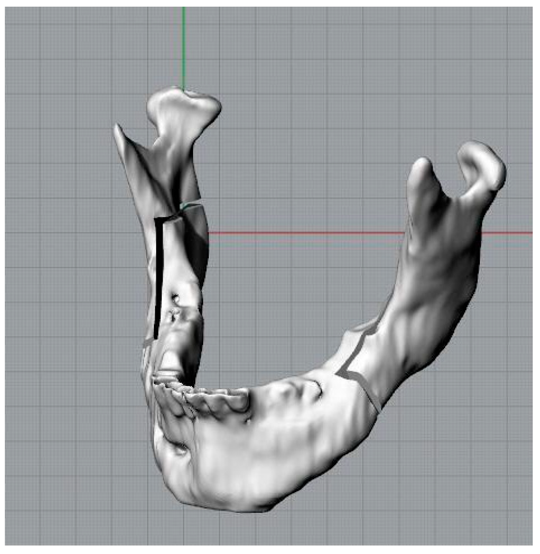 Bioengineering 11 00668 g005
