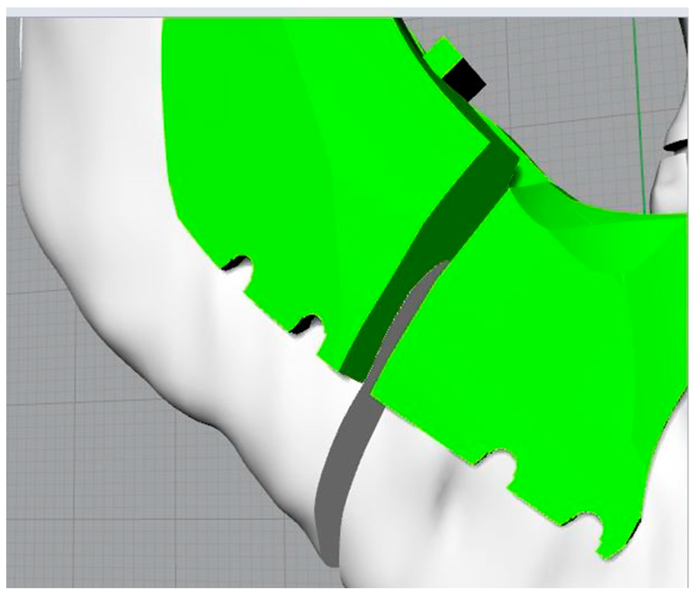 Bioengineering 11 00668 g010