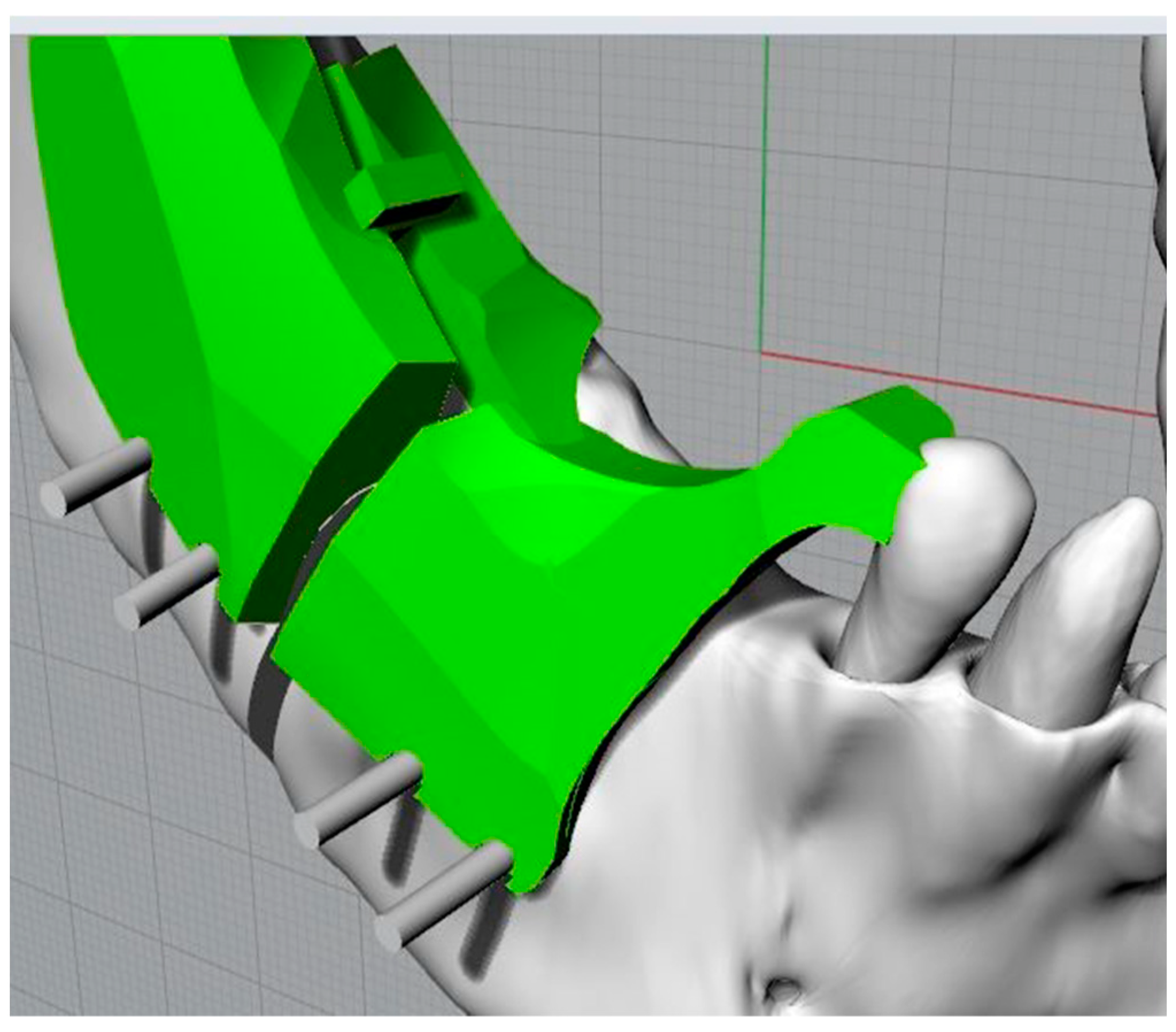 Bioengineering 11 00668 g011