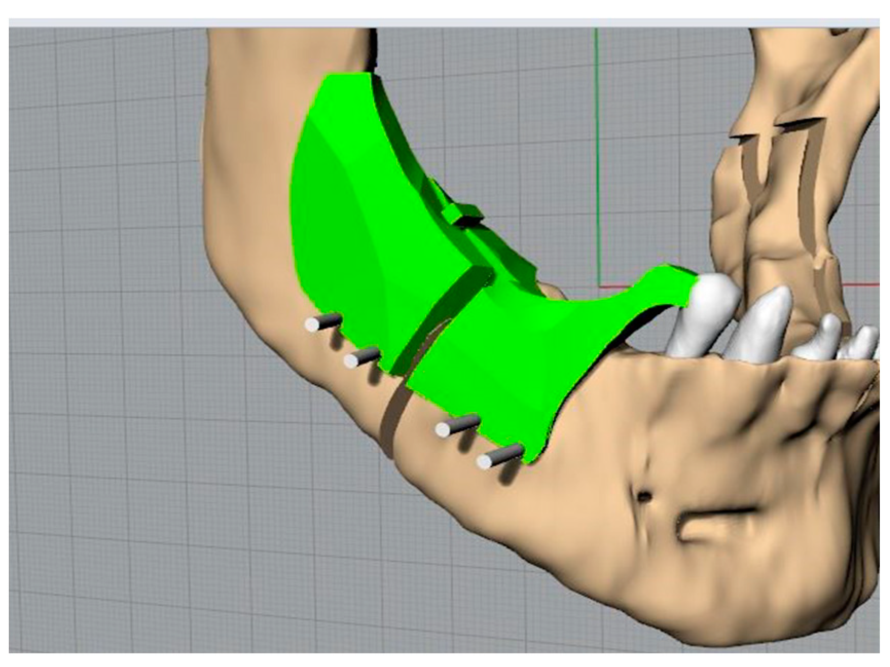 Bioengineering 11 00668 g012