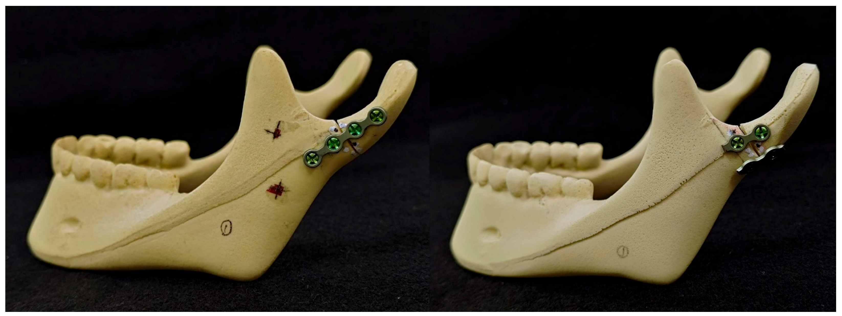 Bioengineering 11 00704 g003