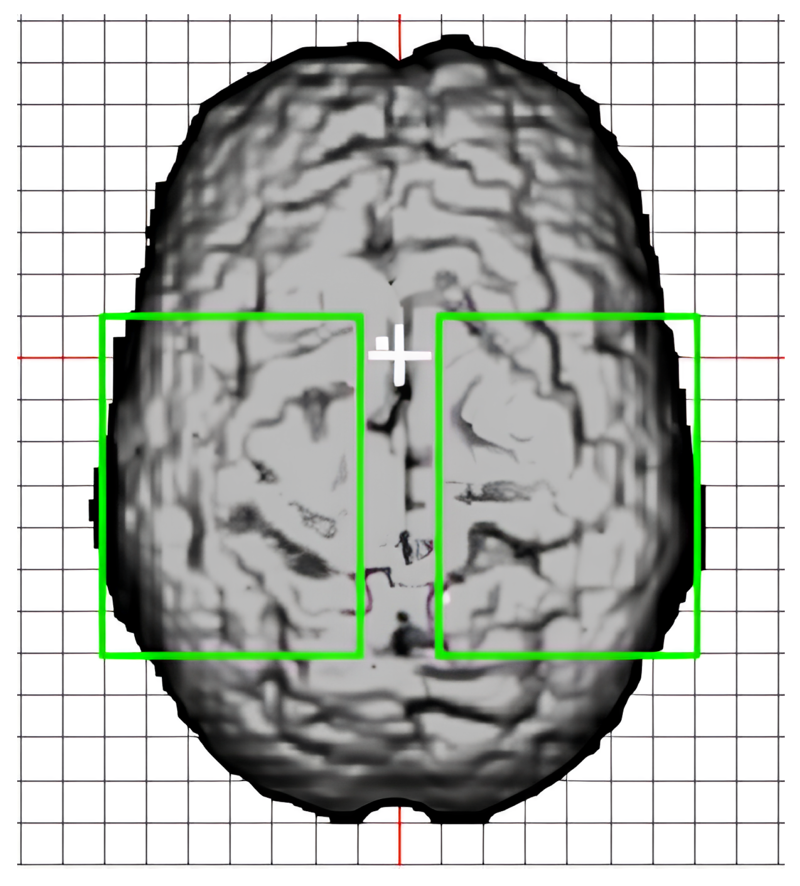 Bioengineering 11 00781 g003