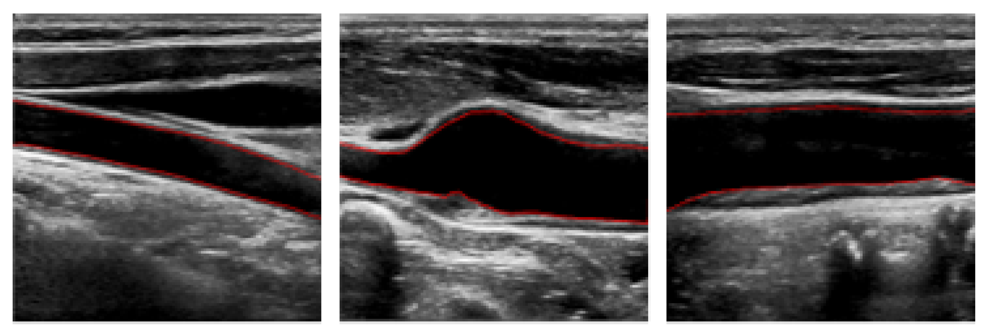 Bioengineering 11 00812 g001
