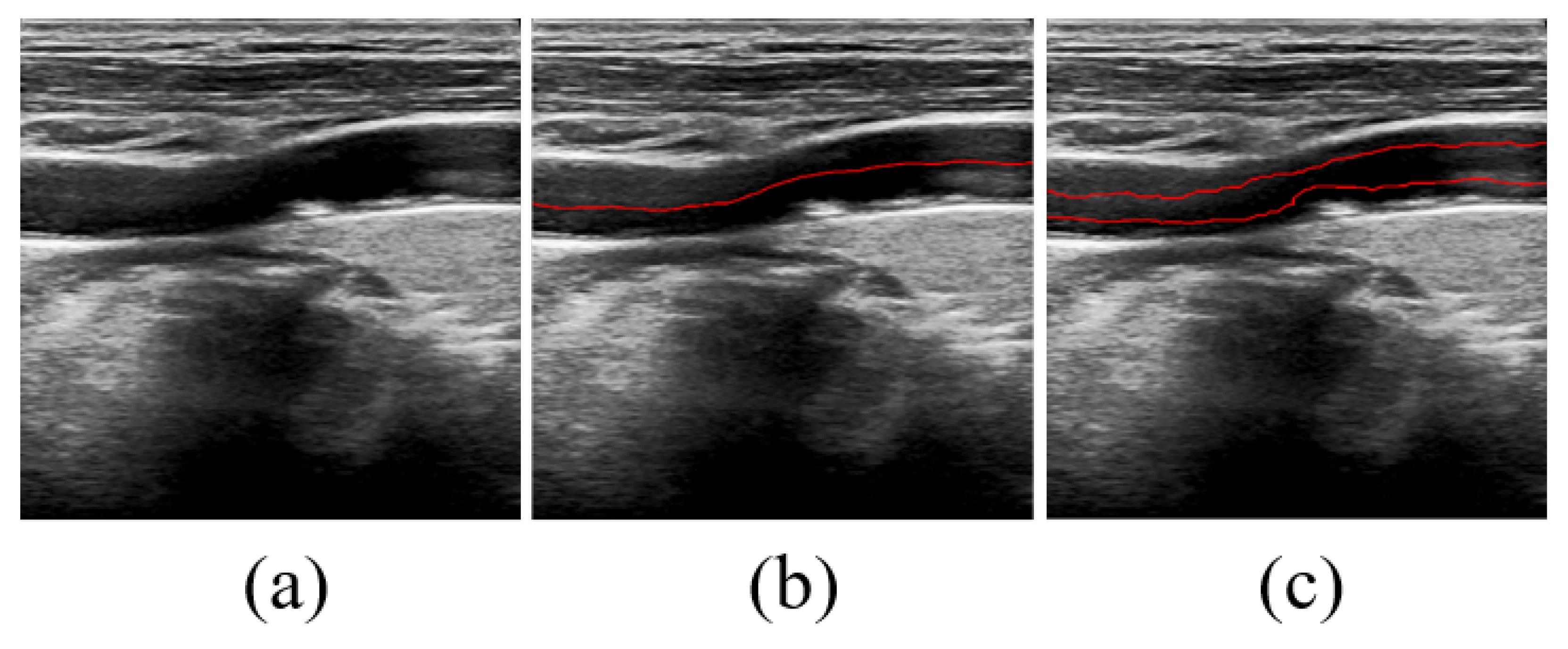 Bioengineering 11 00812 g002