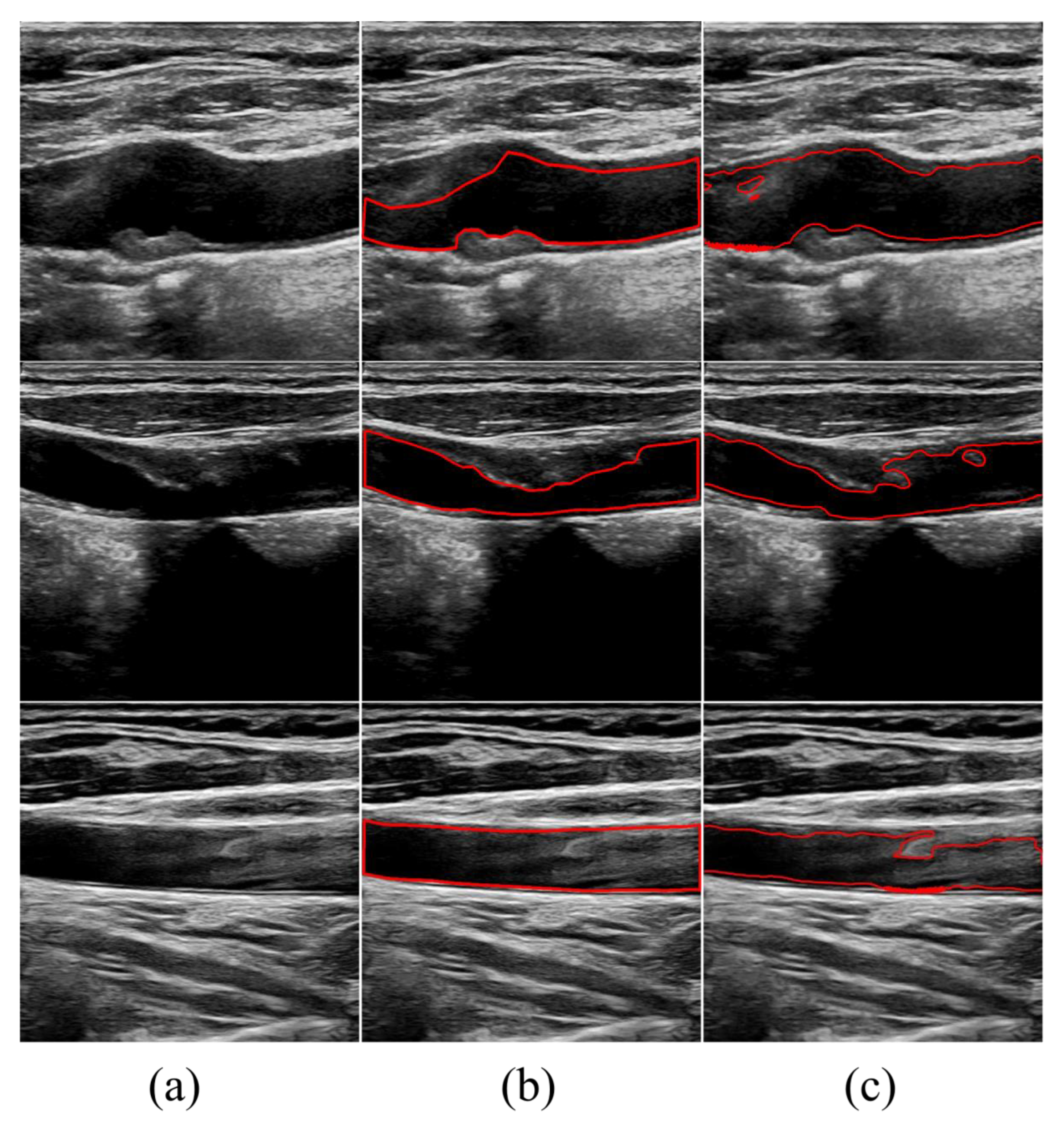 Bioengineering 11 00812 g005