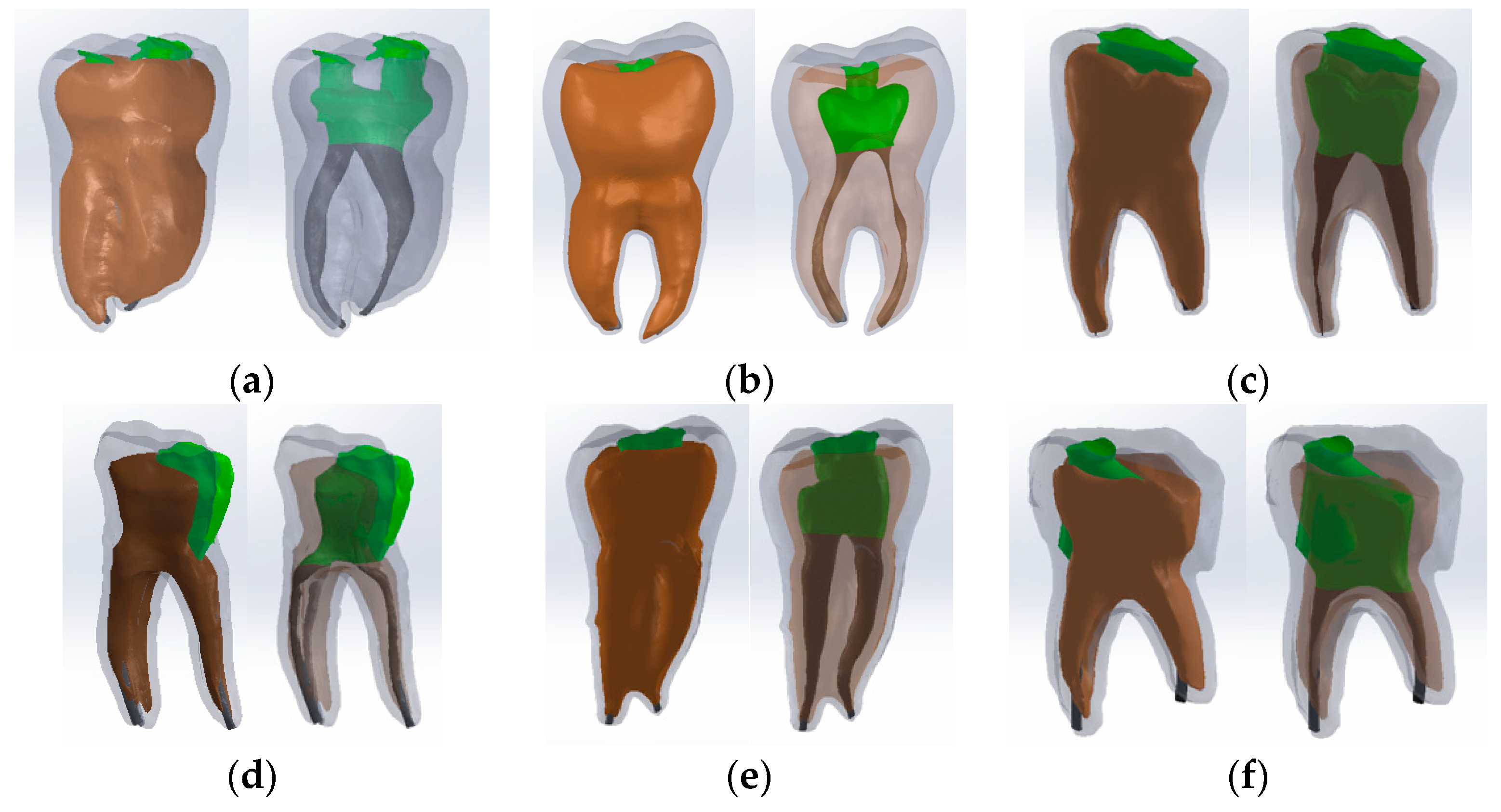 Bioengineering 11 00878 g011