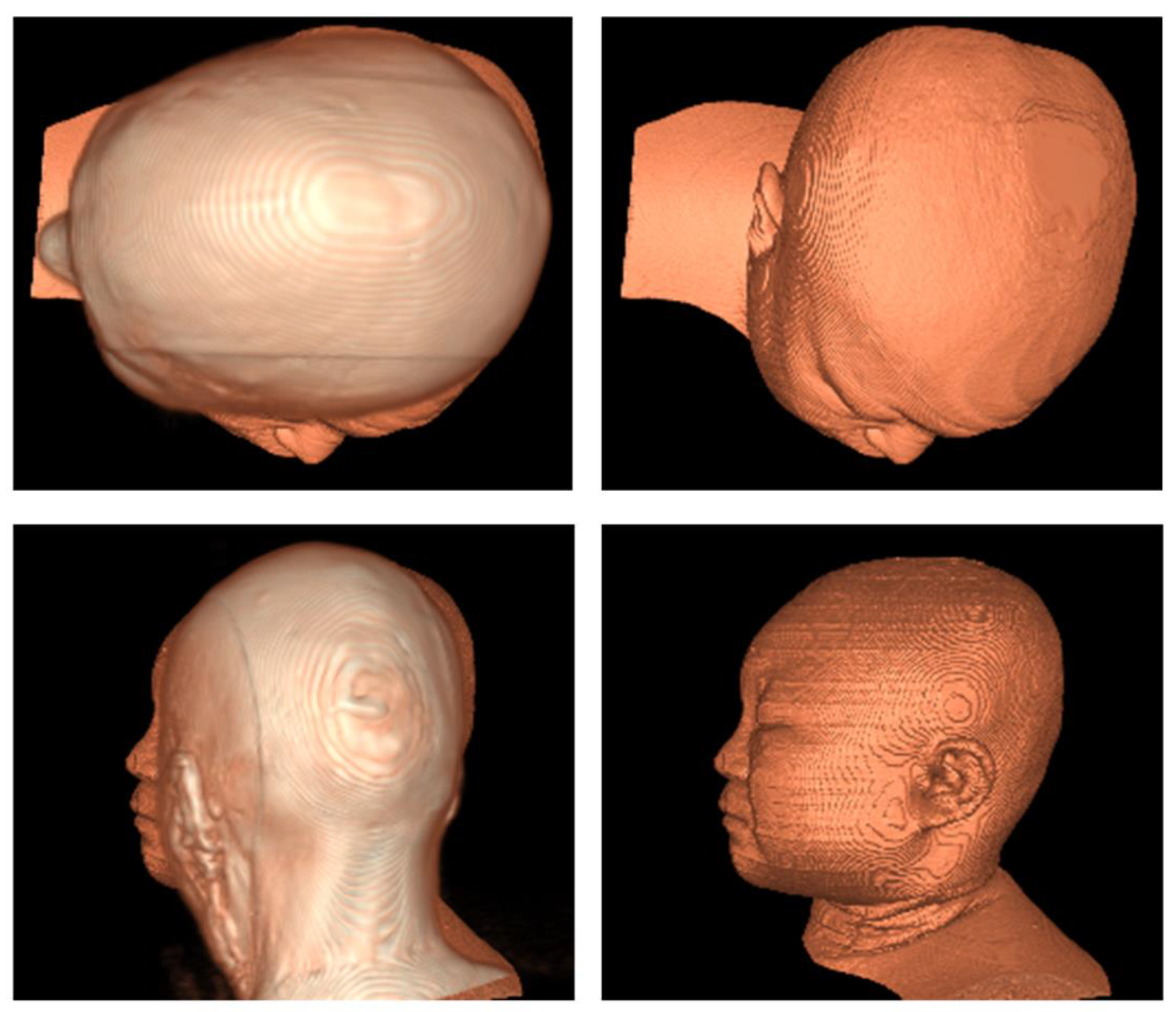 Bioengineering 11 00891 g003