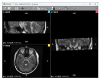 Bioengineering 11 00891 i003