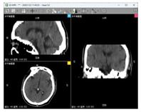Bioengineering 11 00891 i004