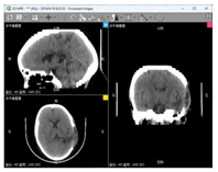 Bioengineering 11 00891 i006