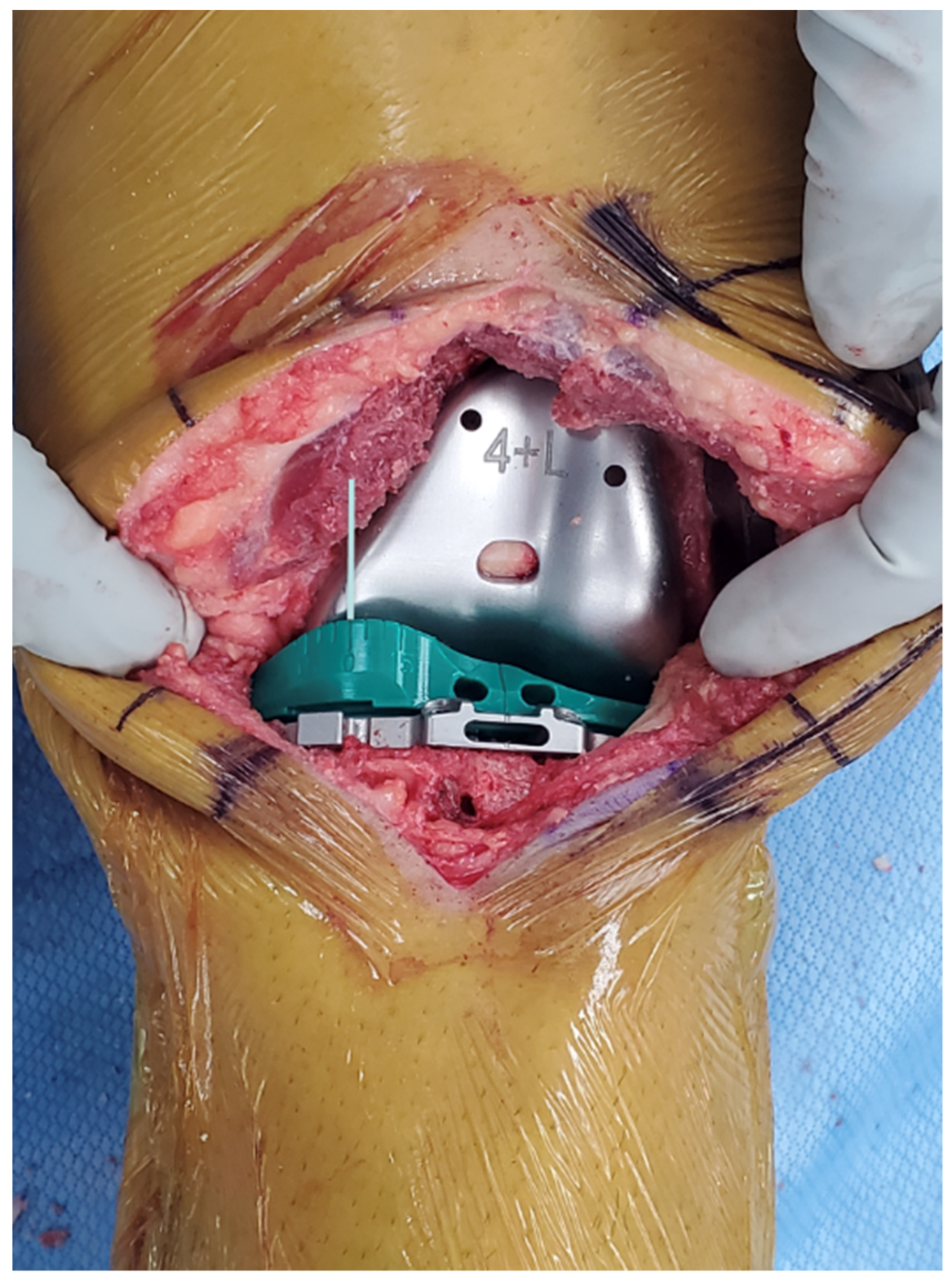 Bioengineering 11 00910 g005