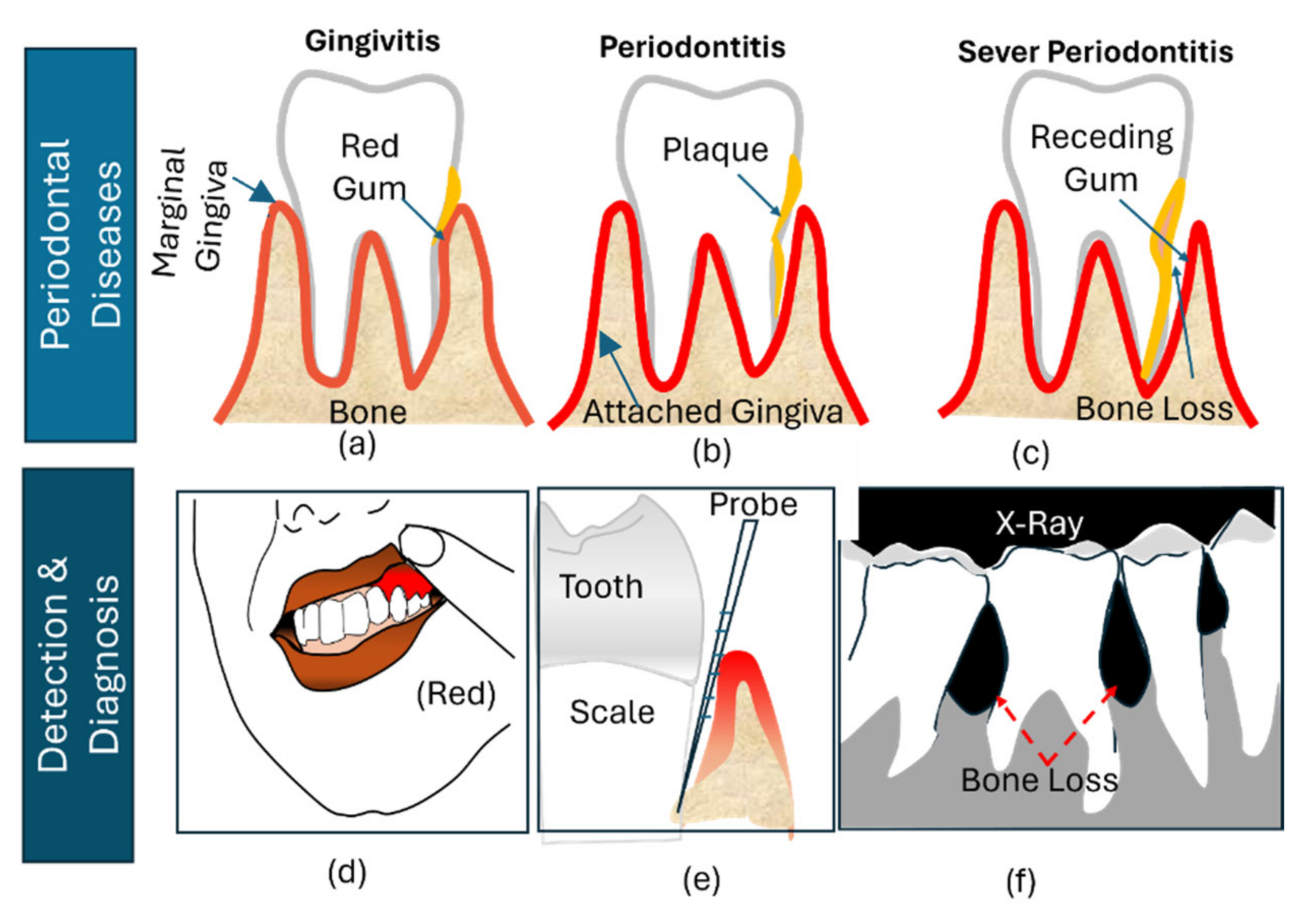 Toward Digital Periodontal Health: Recent Advances and Future 