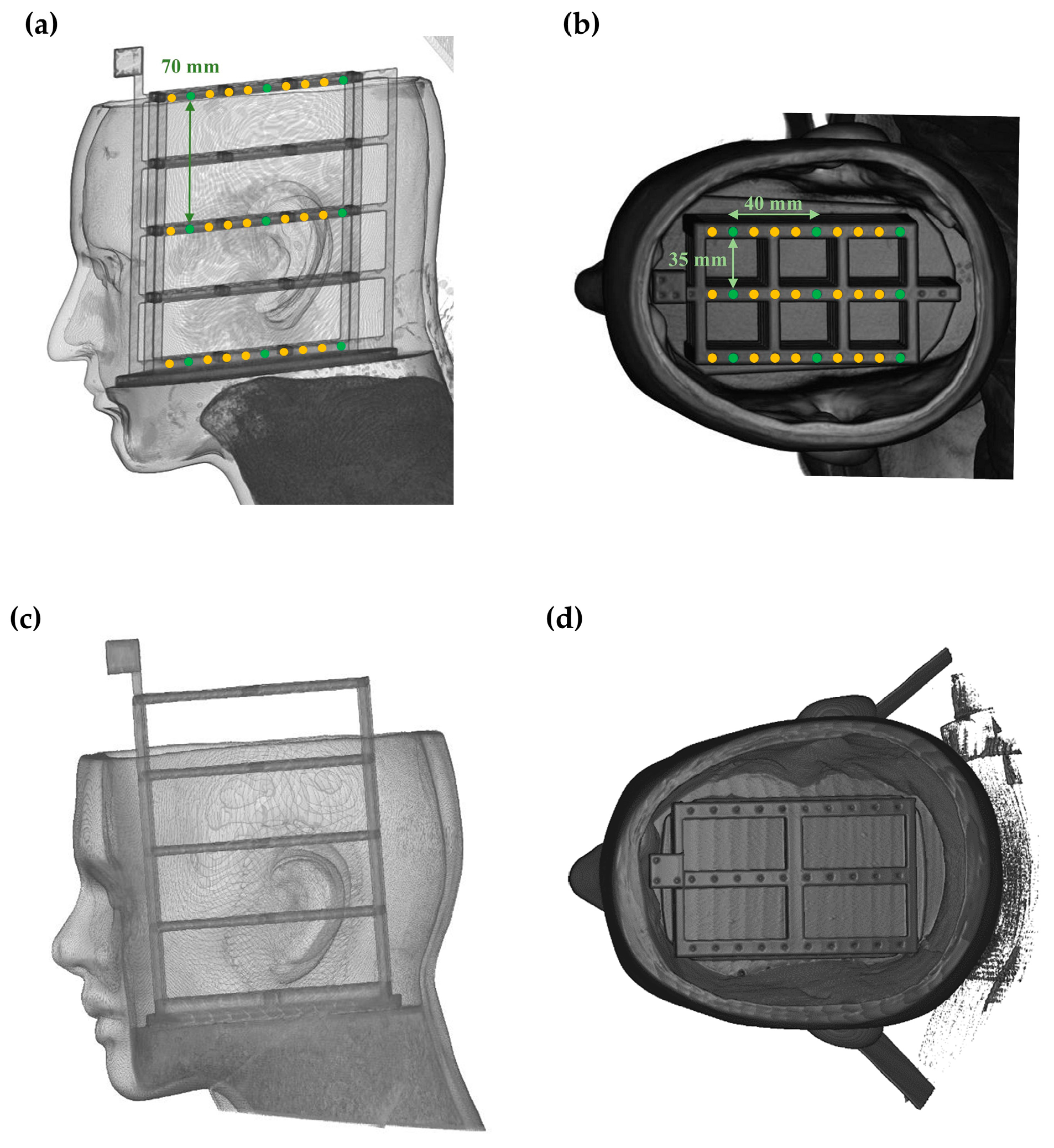 Bioengineering 11 00941 g005