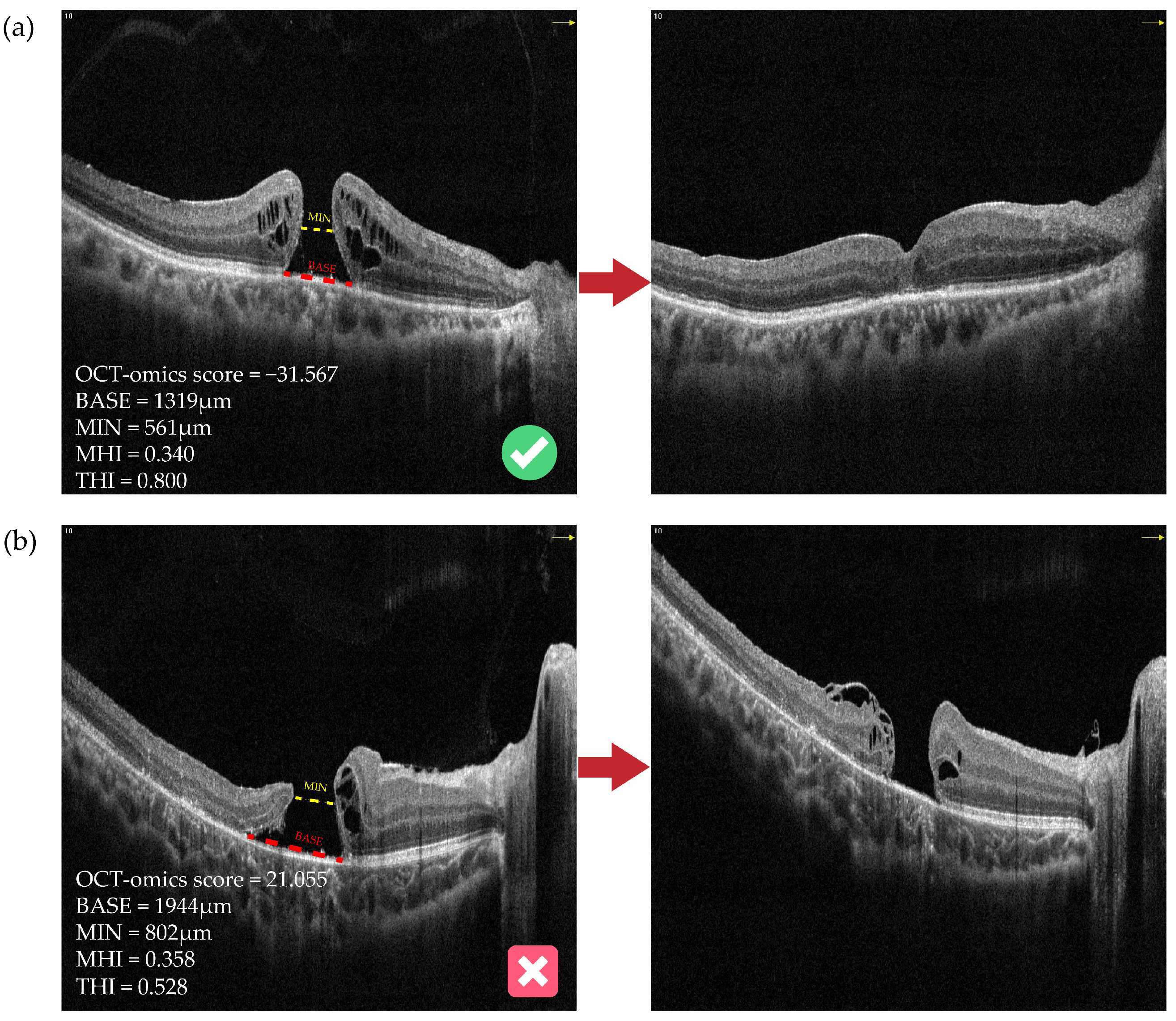 Bioengineering 11 00949 g005