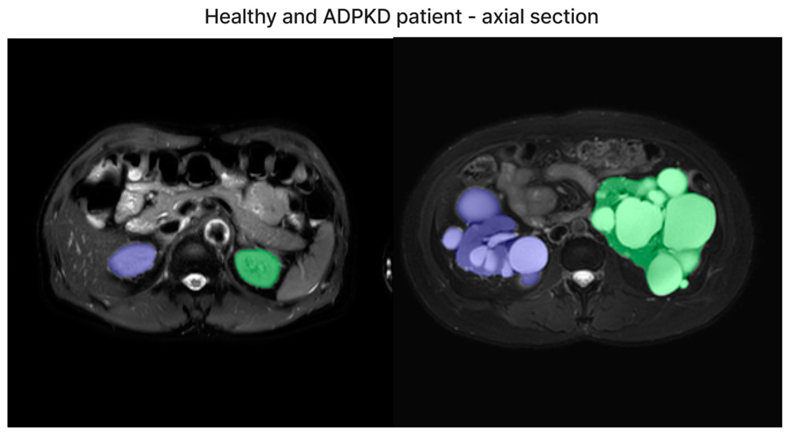 Bioengineering 11 00963 g006
