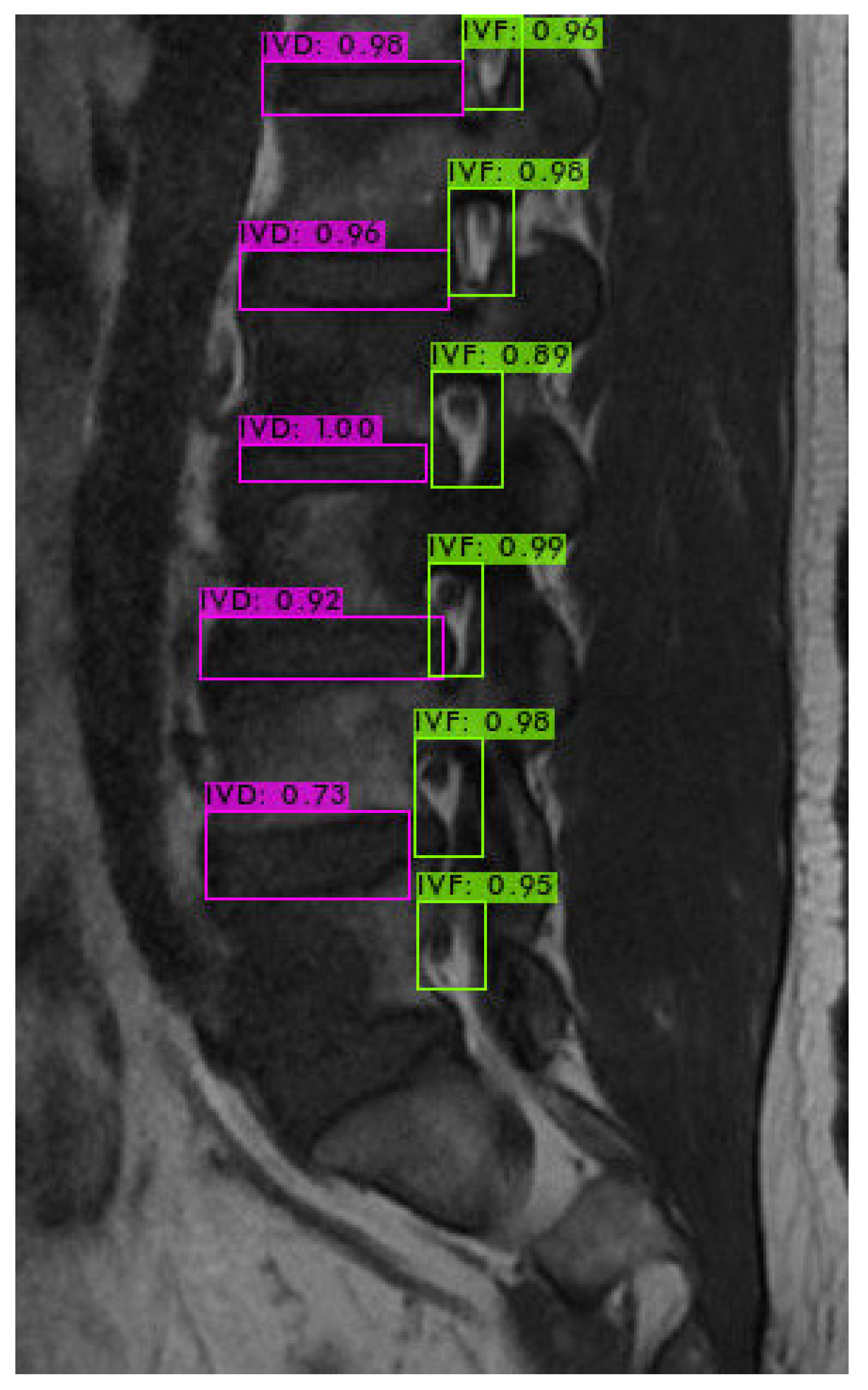 Bioengineering 11 00981 g009