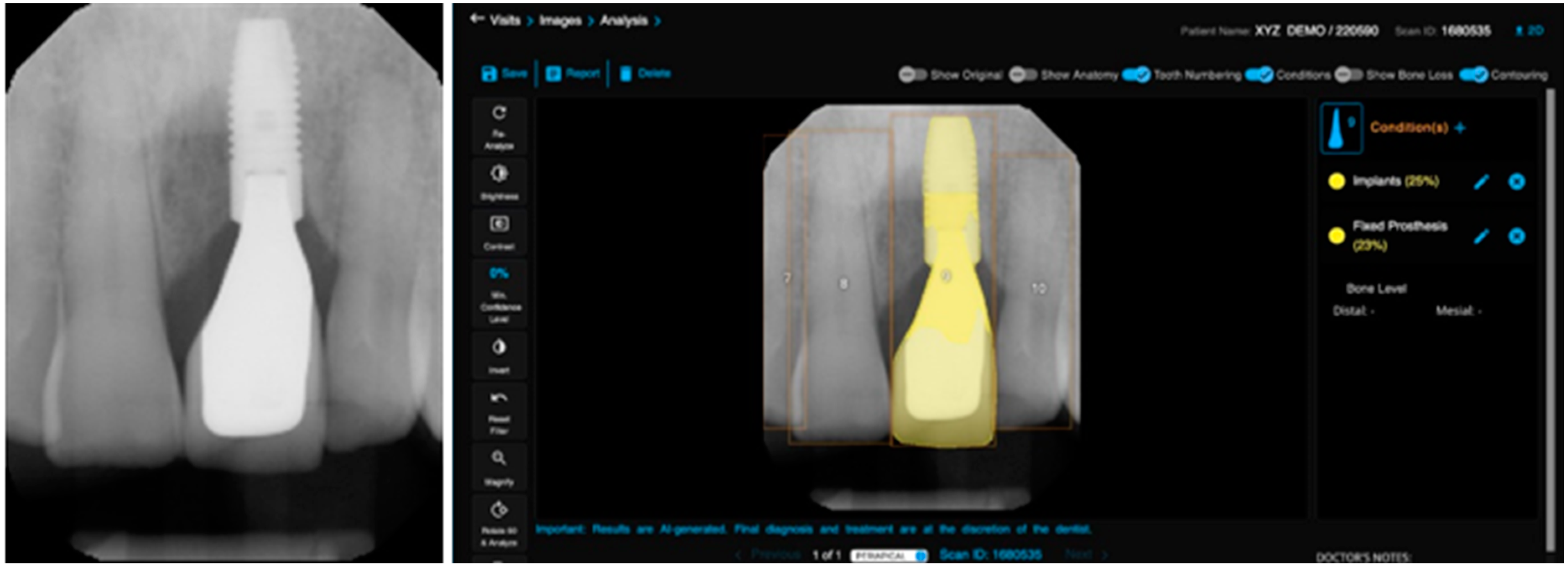 Bioengineering 11 01001 g004