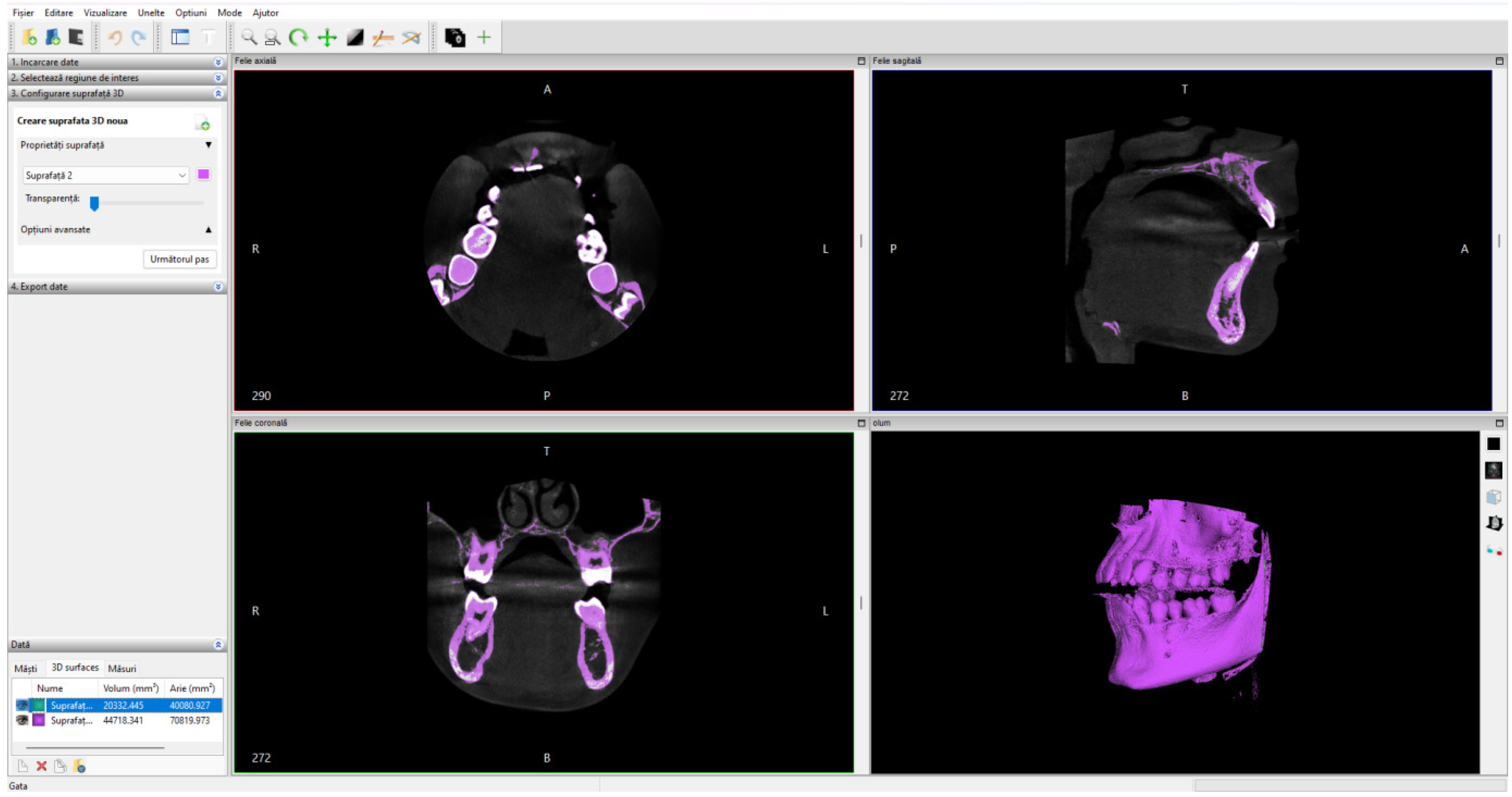 Bioengineering 11 01002 g006