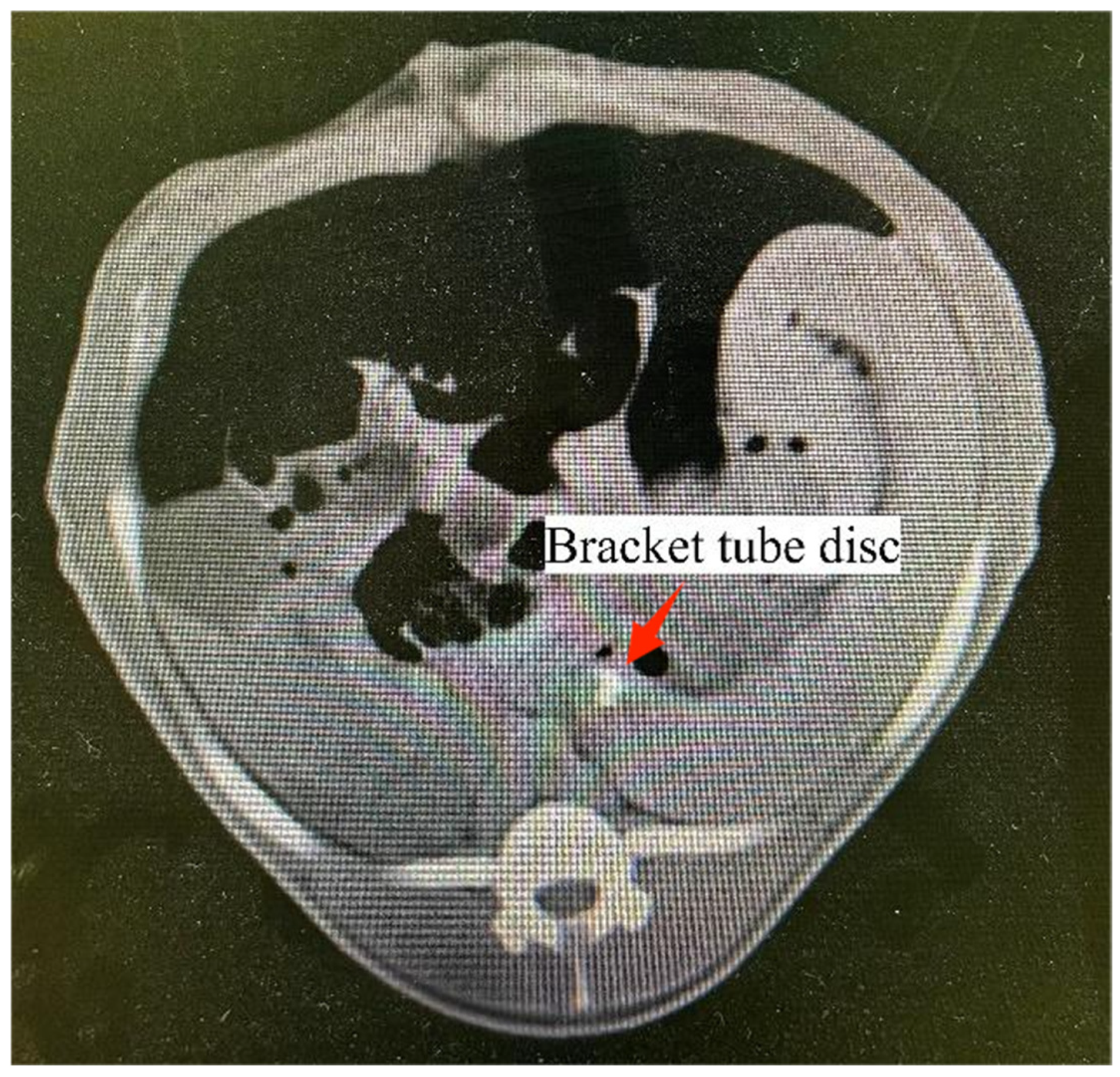 Bioengineering 11 01004 g008