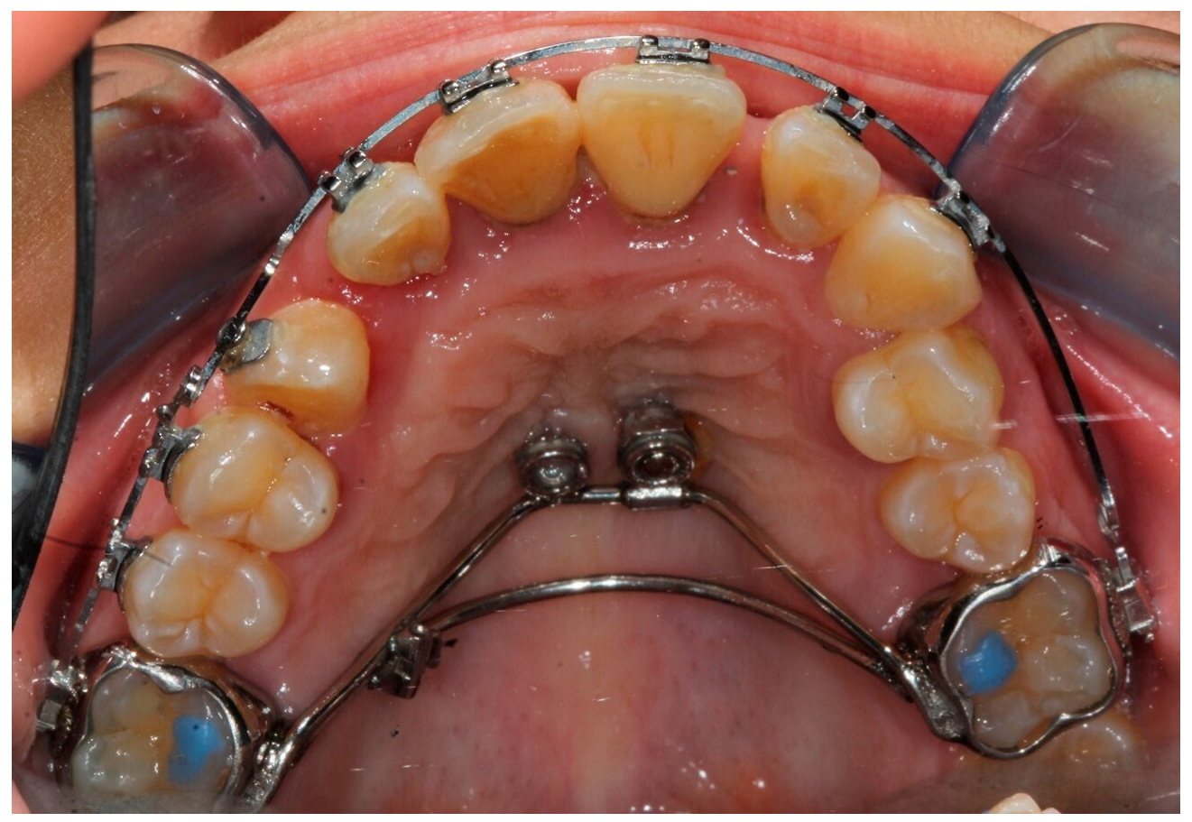 Bioengineering 11 01023 g004