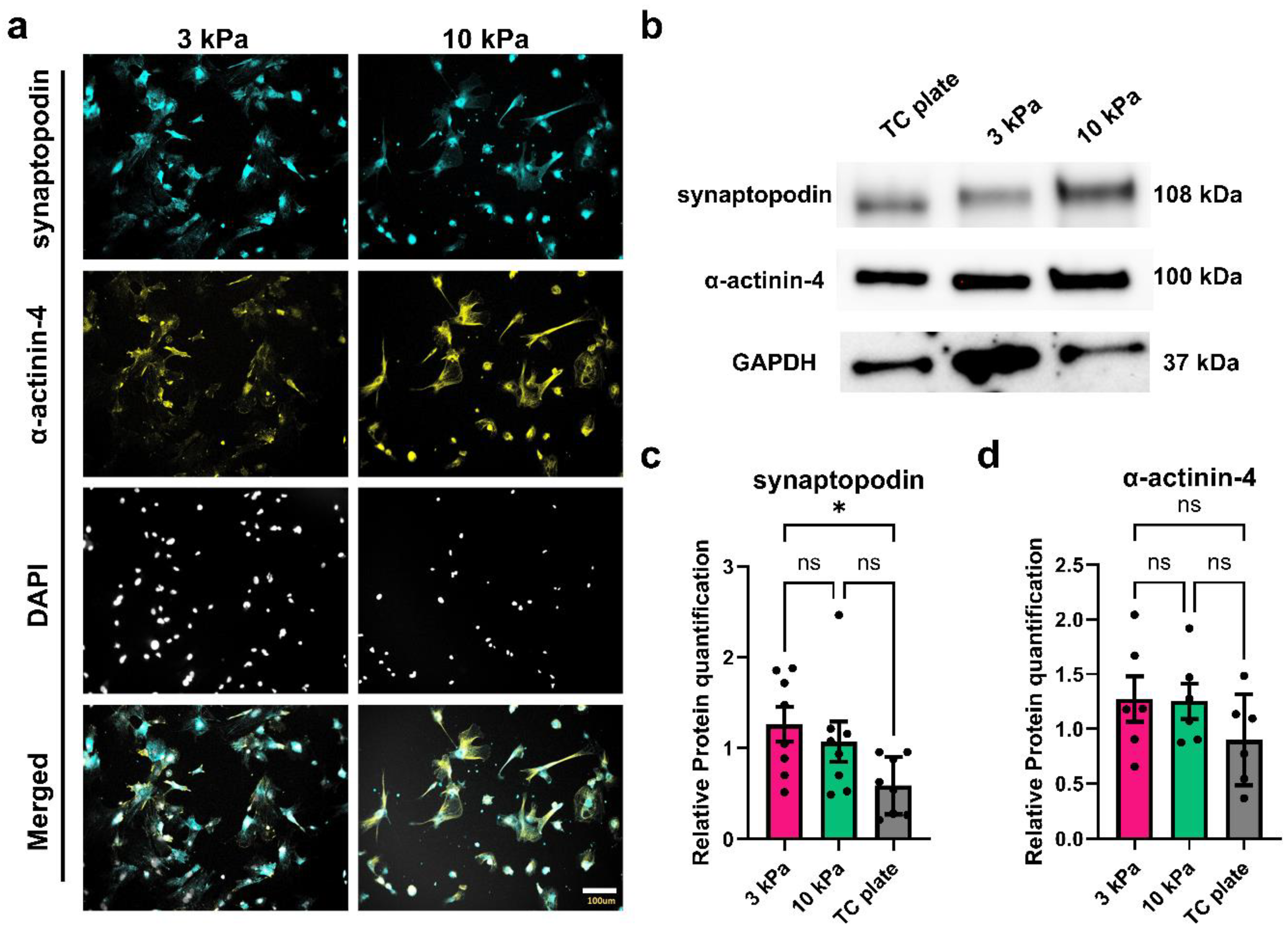 Bioengineering 11 01038 g004