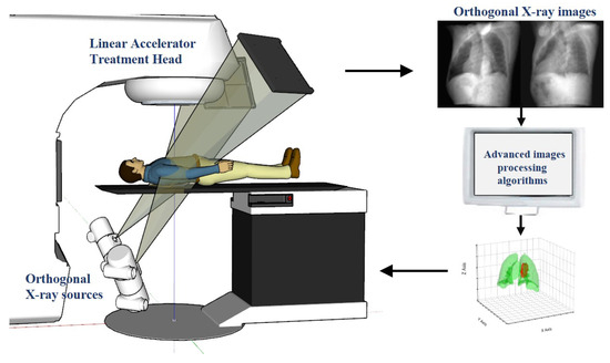 Image Panel Radiotherapy Robust Real-Time Cancer Tracking via Dual-Panel X-Ray Images for ...