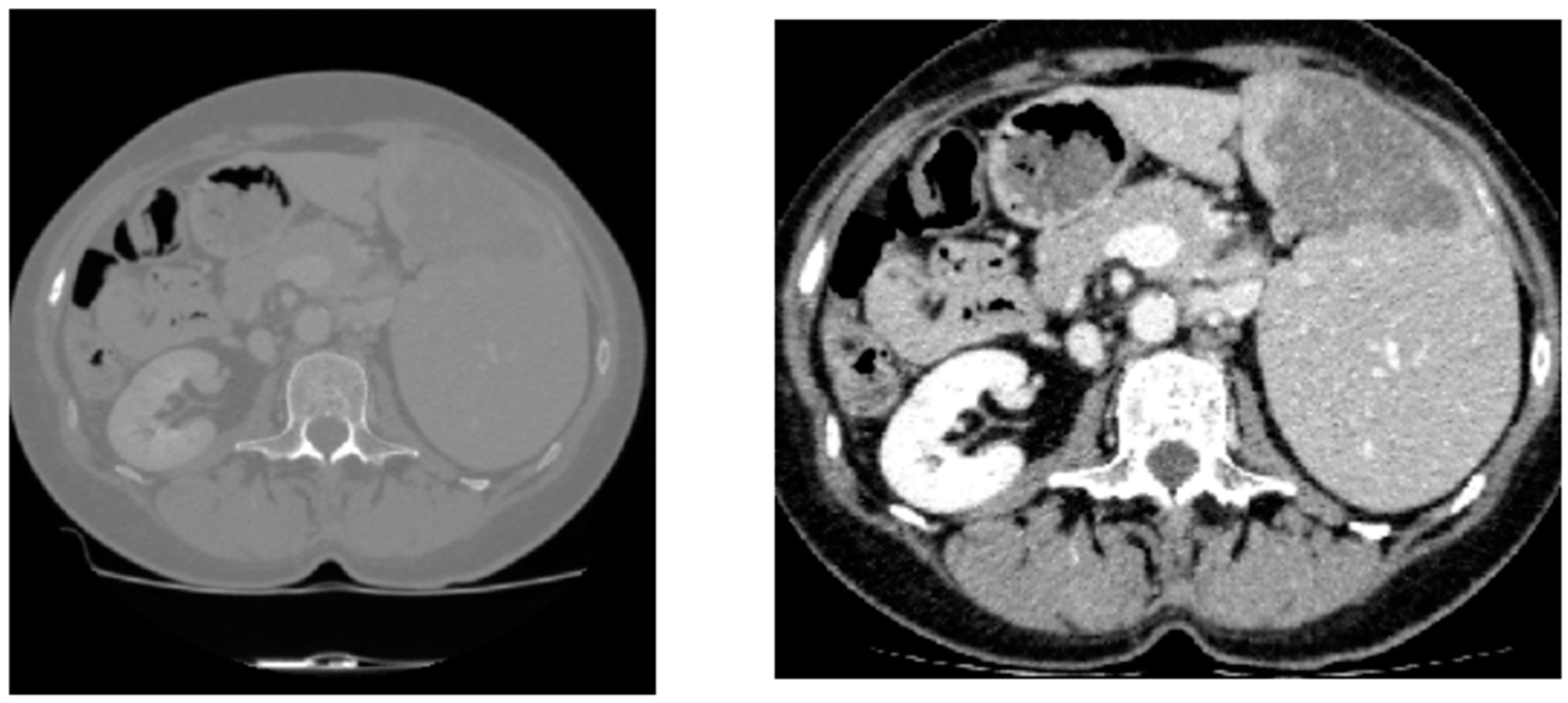 Bioengineering 11 01073 g006