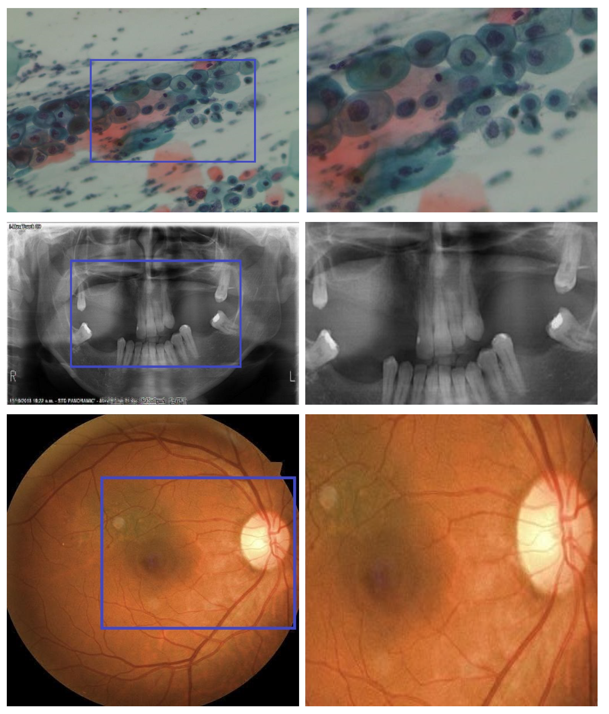 Bioengineering 11 01101 g003a