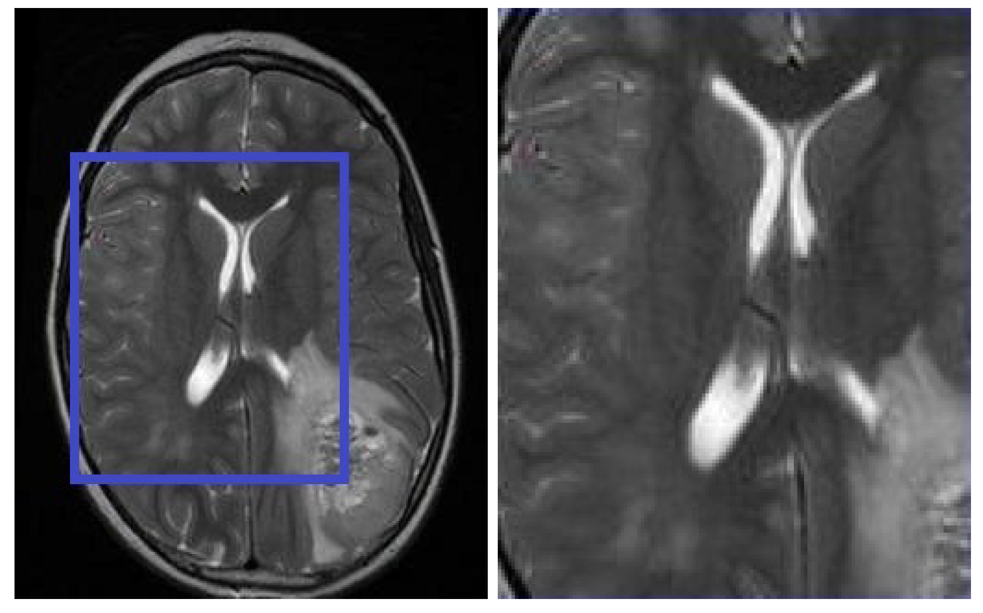 Bioengineering 11 01101 g003b