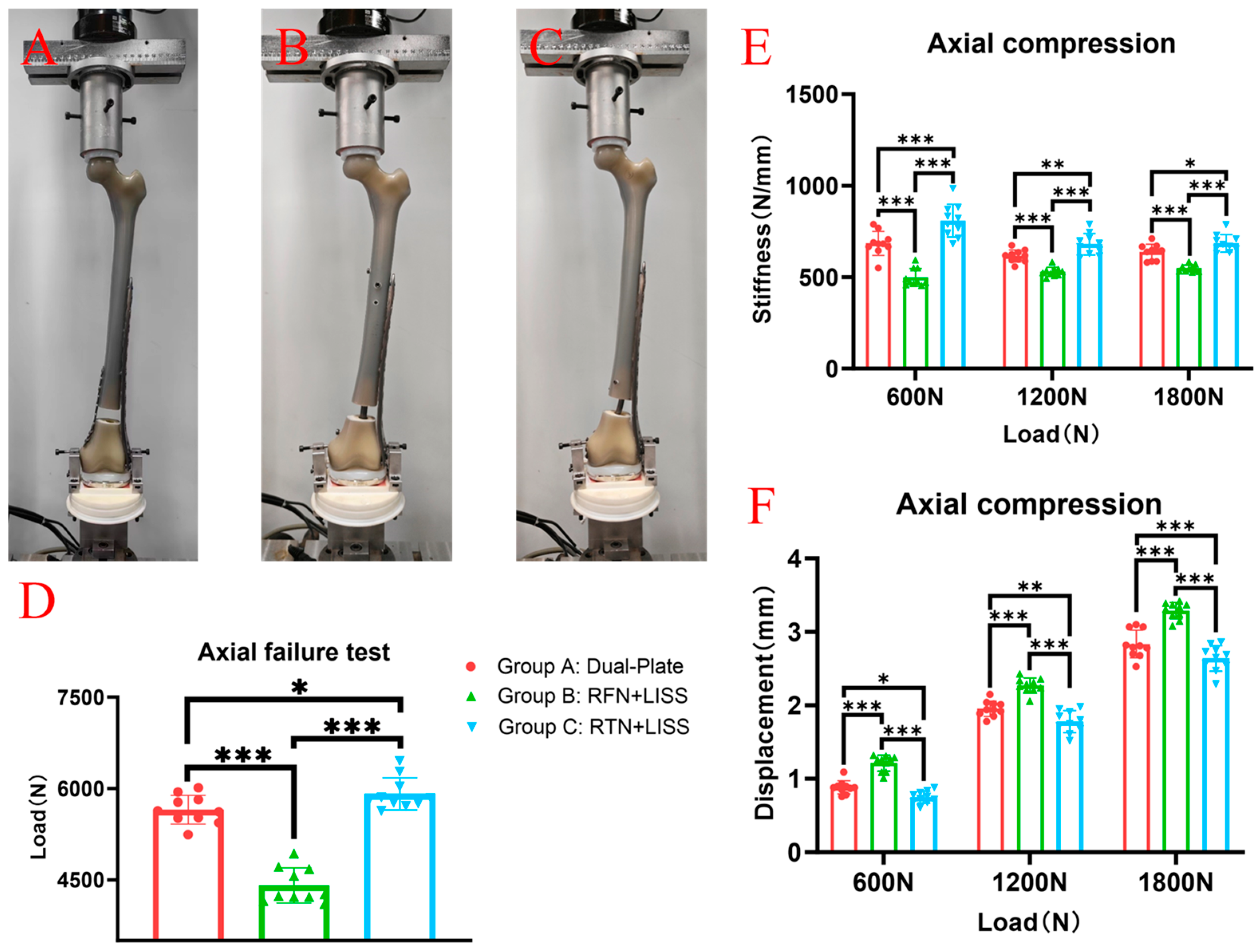 Comparison of Three Internal Fixation Constructs for AO/OTA