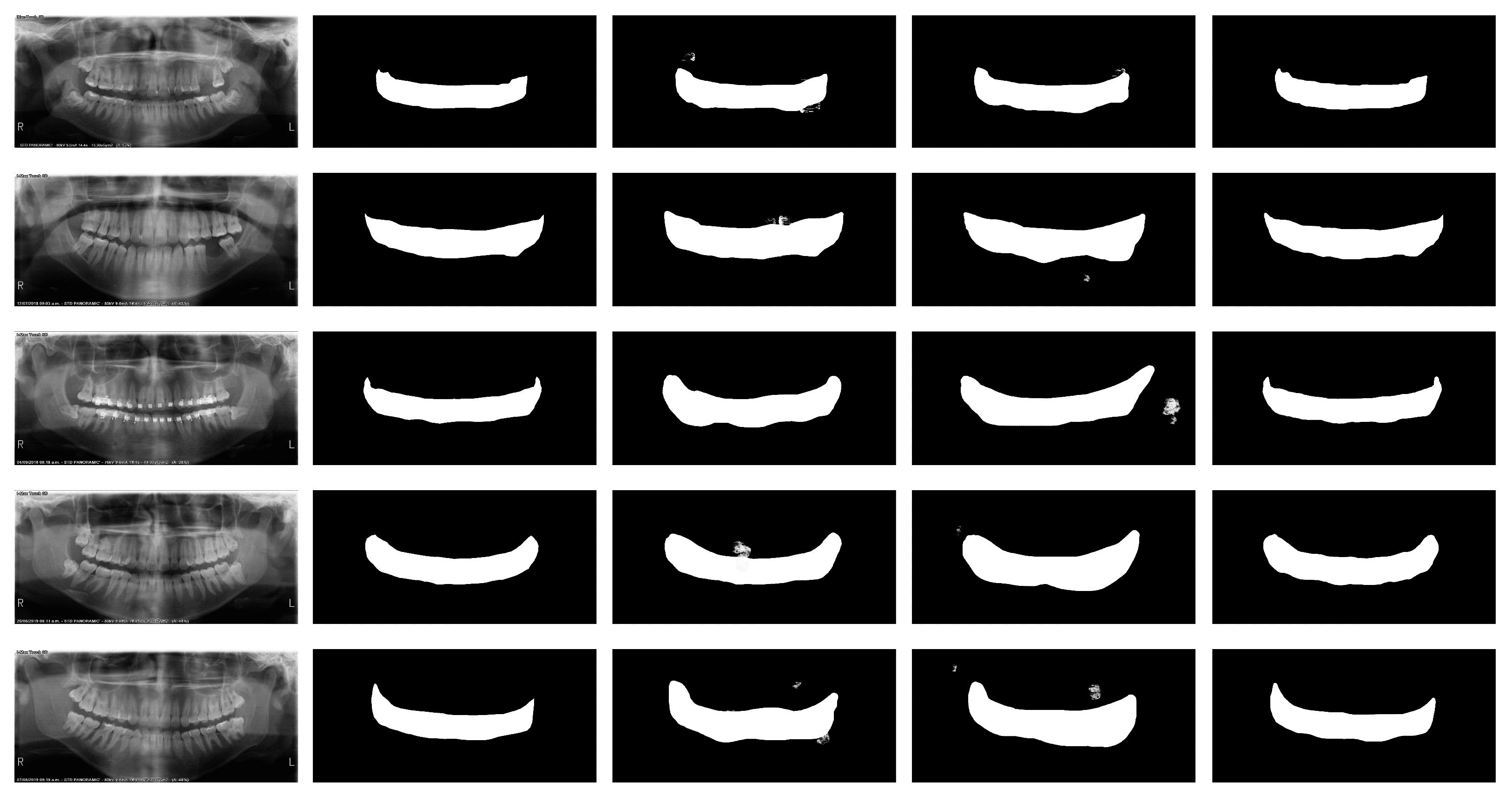 Bioengineering 11 01130 g006