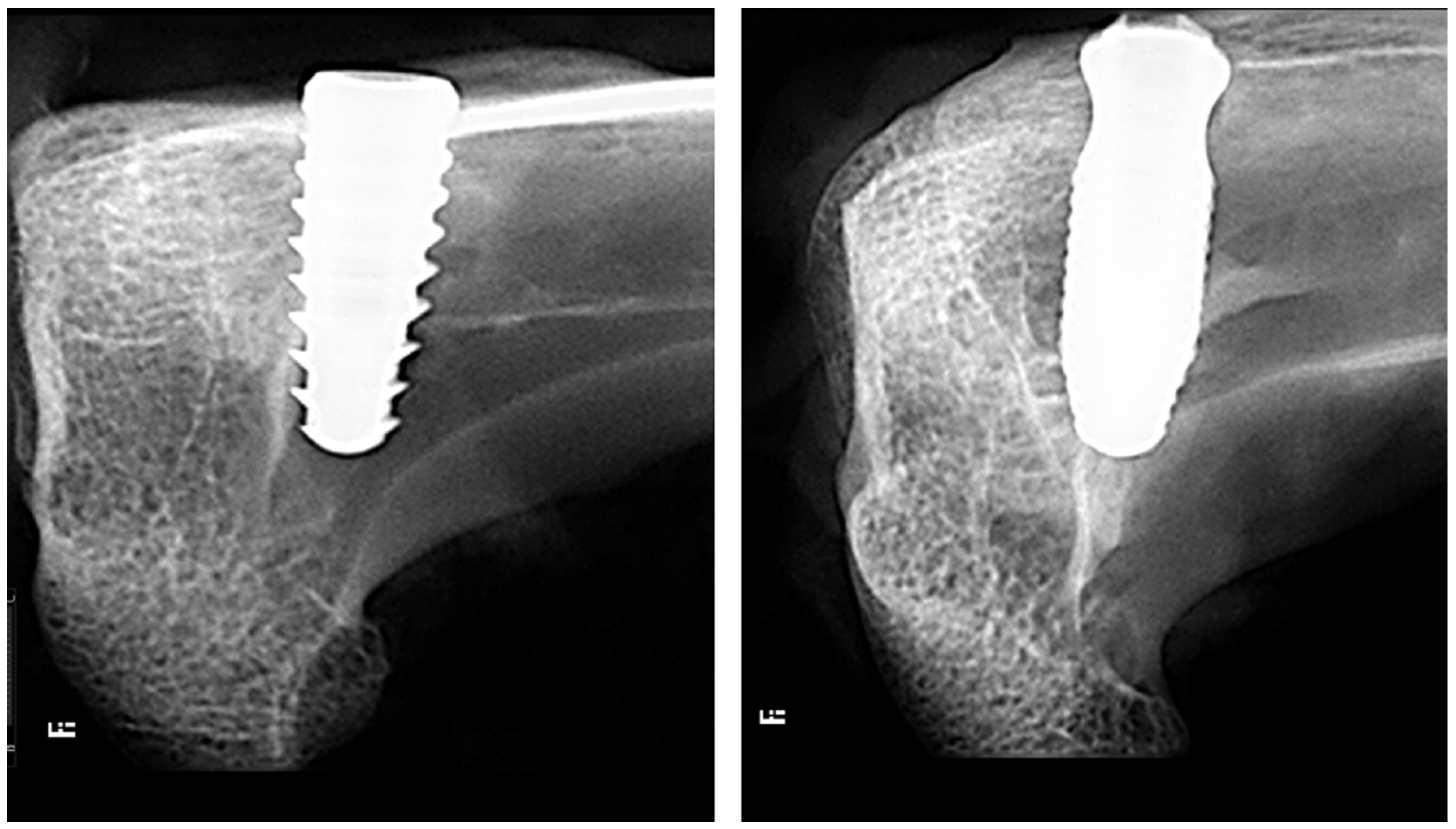 Bioengineering 11 01155 g005