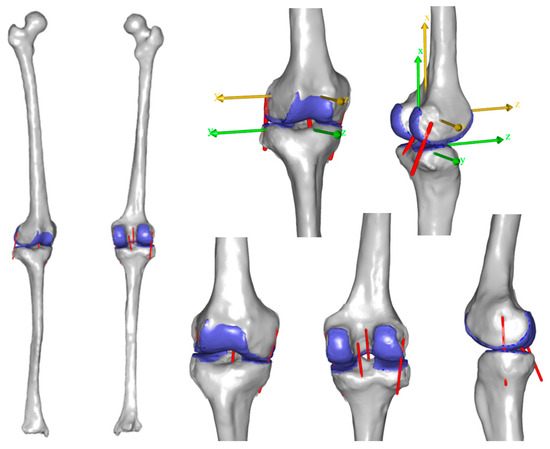 Influence of the Initial Guess on the Estimation of Knee Ligament 