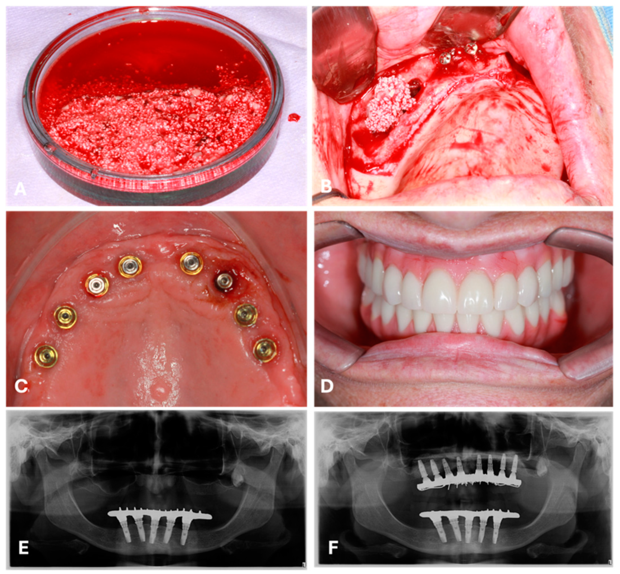 Bioengineering 11 01207 g001