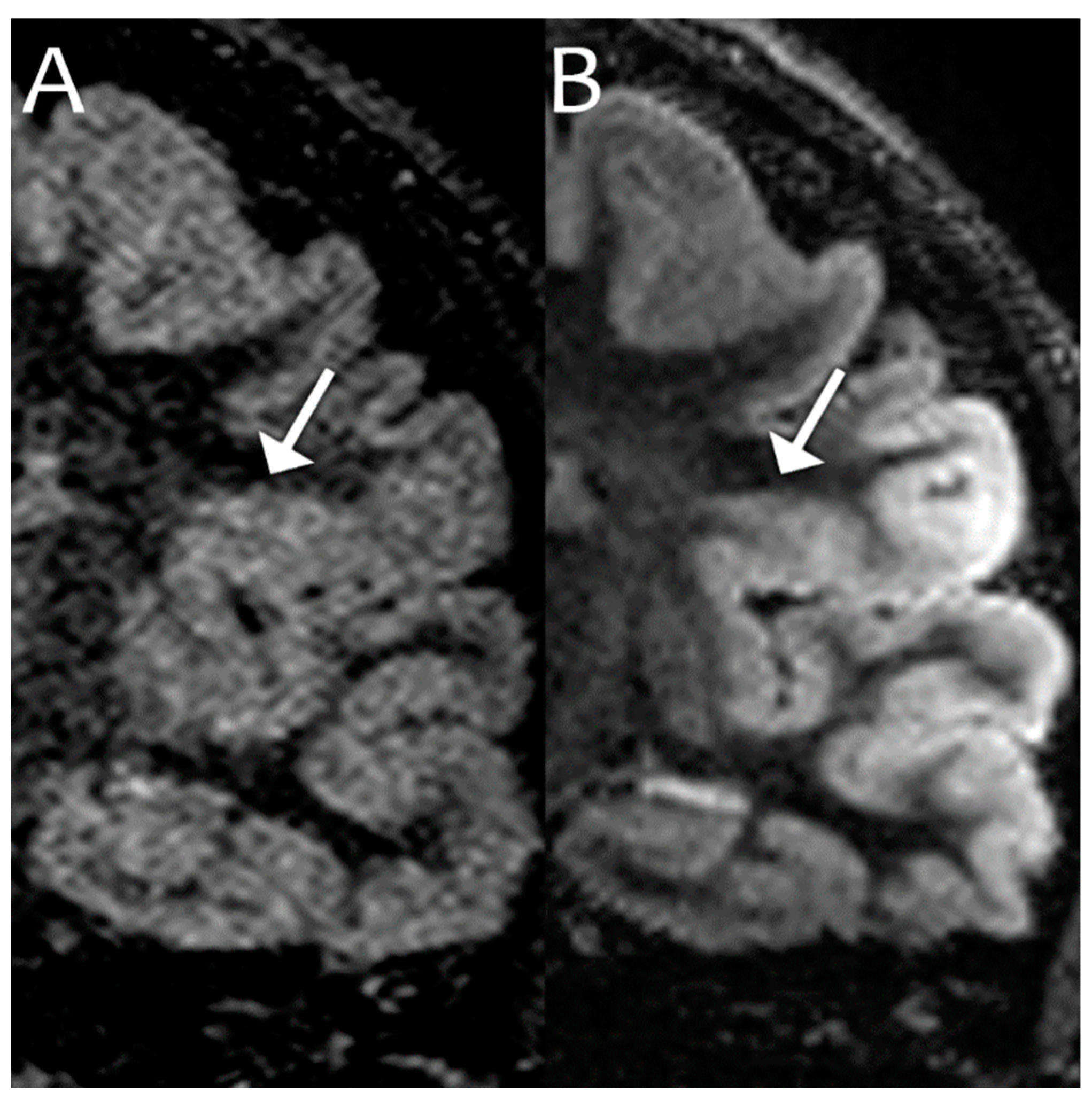 MRI 一問一答 MRI一問一答: 撮像法選択と読影に“必ず”役立つ基礎知識 | 平井