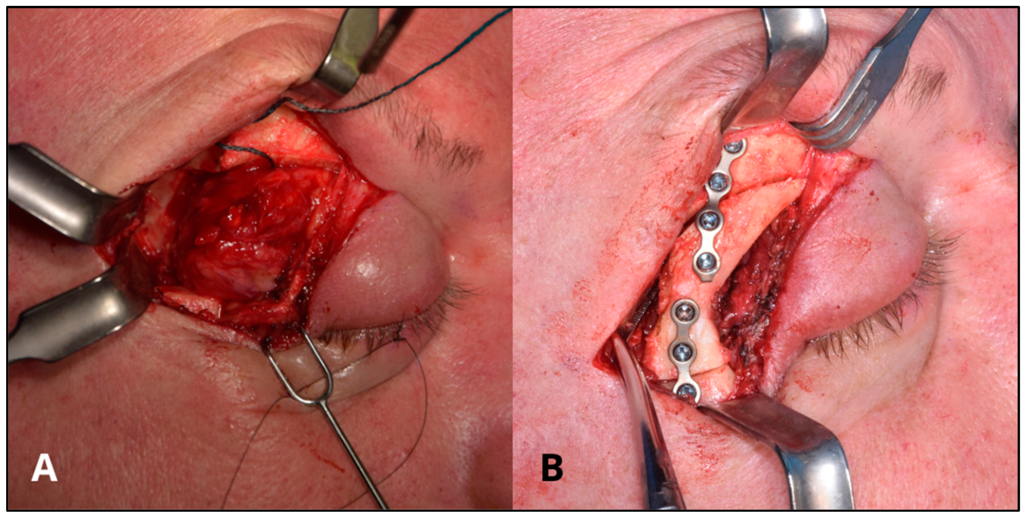 Bioengineering 11 01238 g004