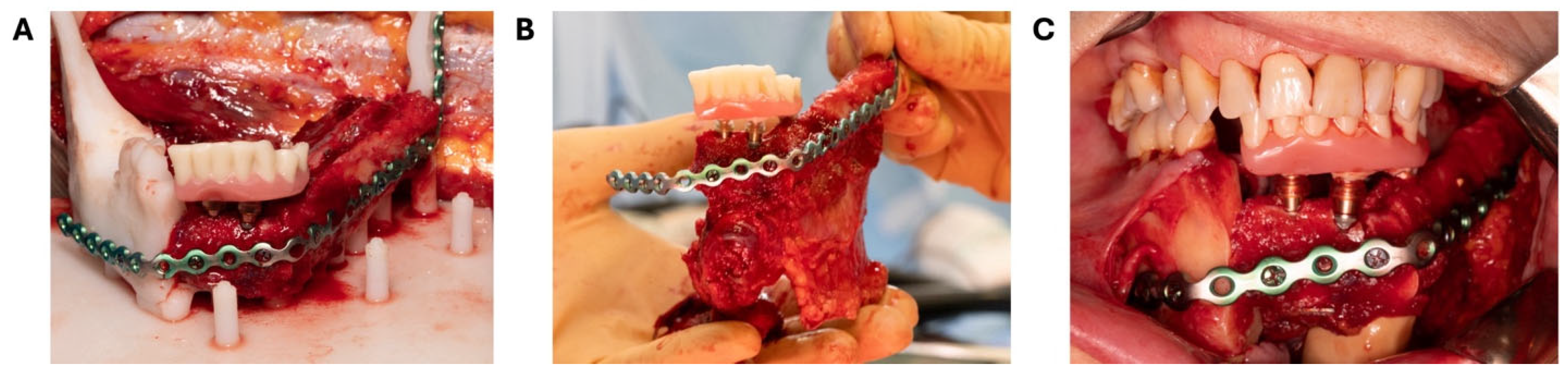 Bioengineering 11 01254 g007