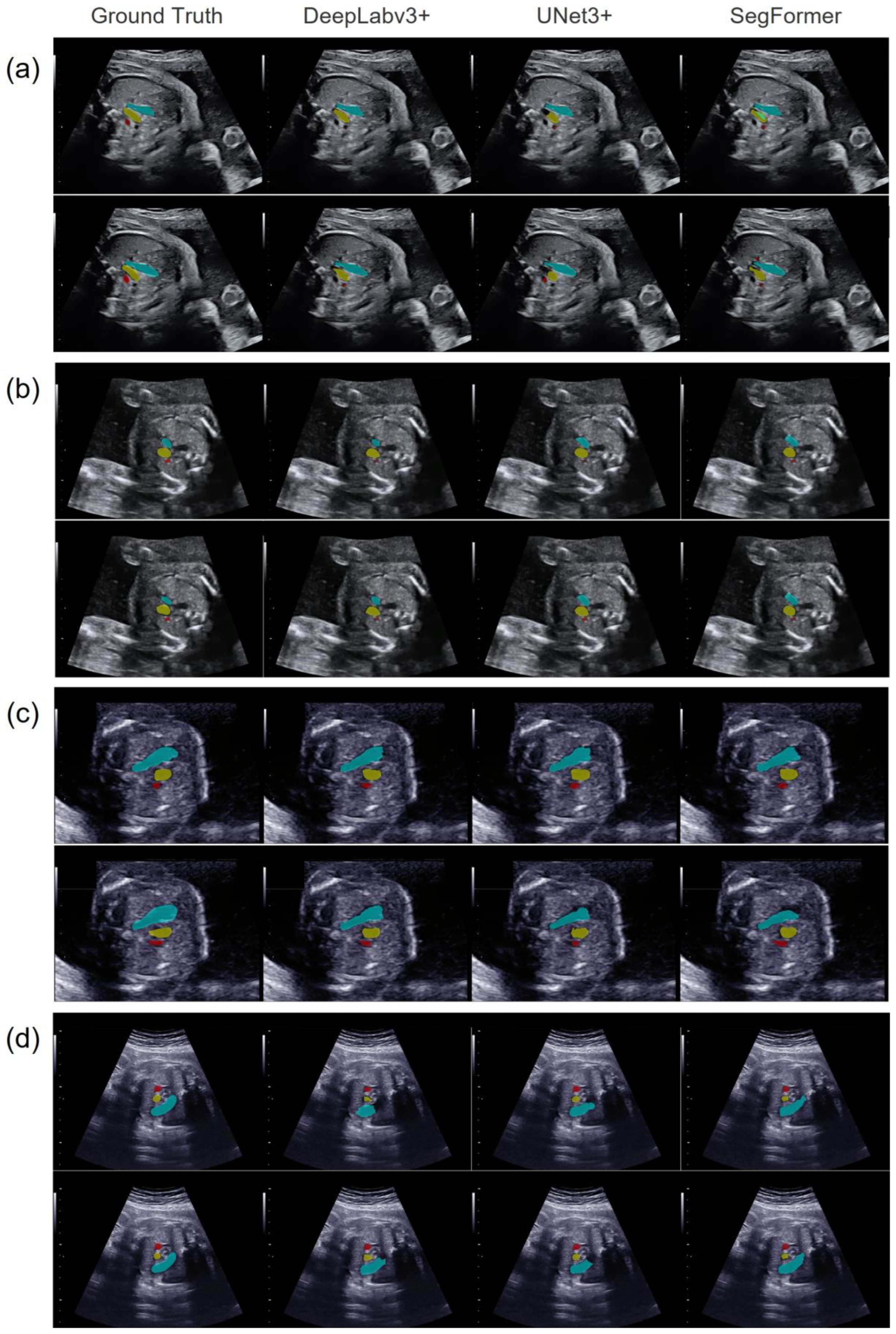 Bioengineering 11 01256 g003