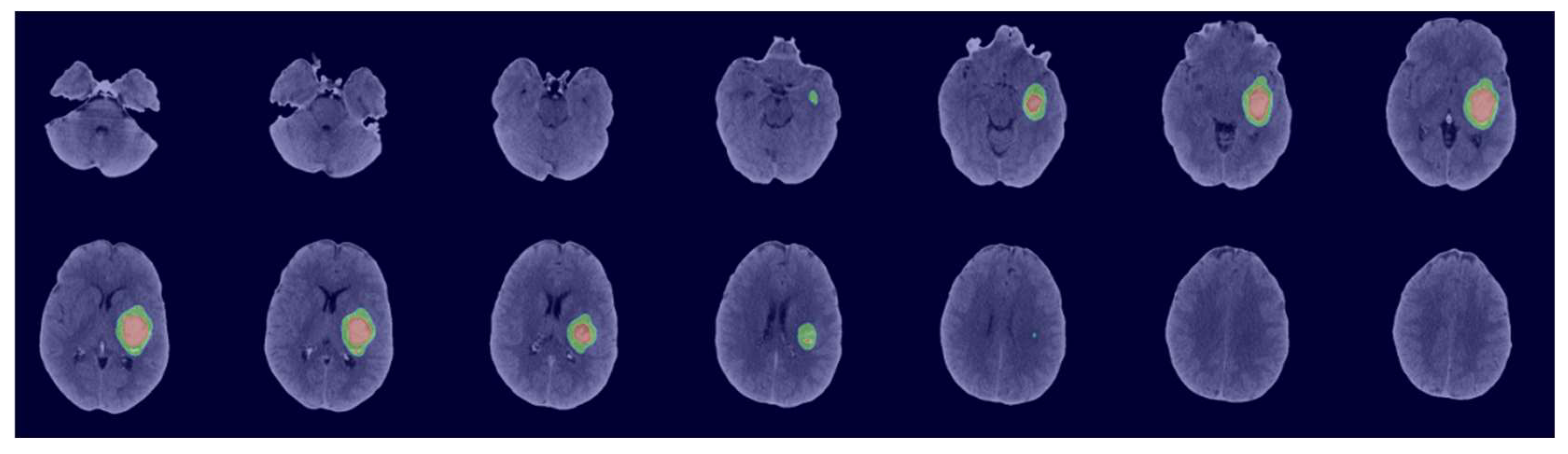 Bioengineering 11 01274 g006