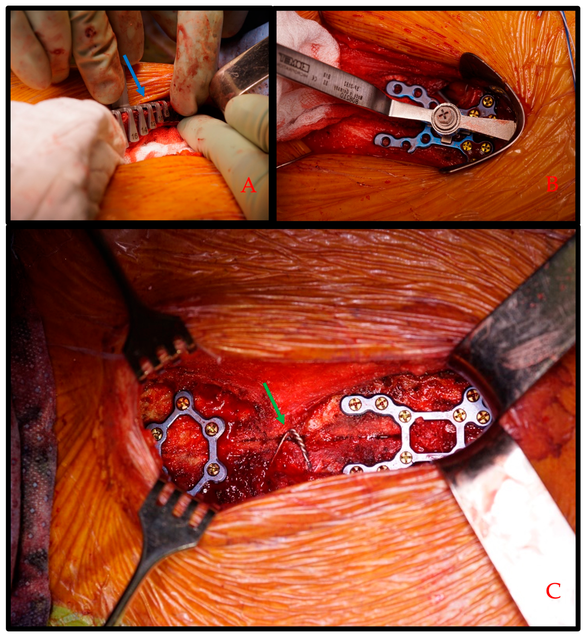 Bioengineering 11 01280 g003