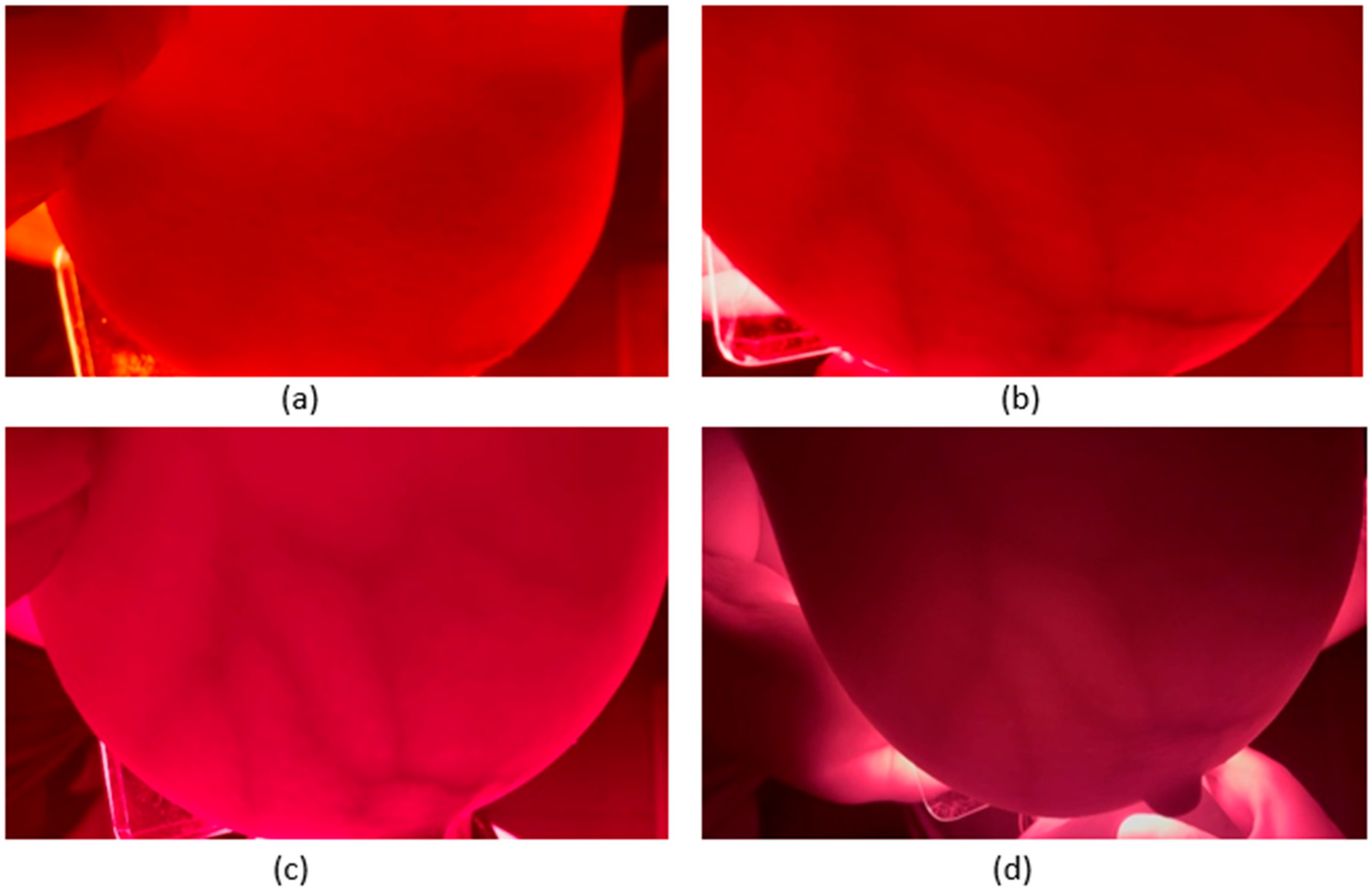 Bioengineering 11 01281 g004