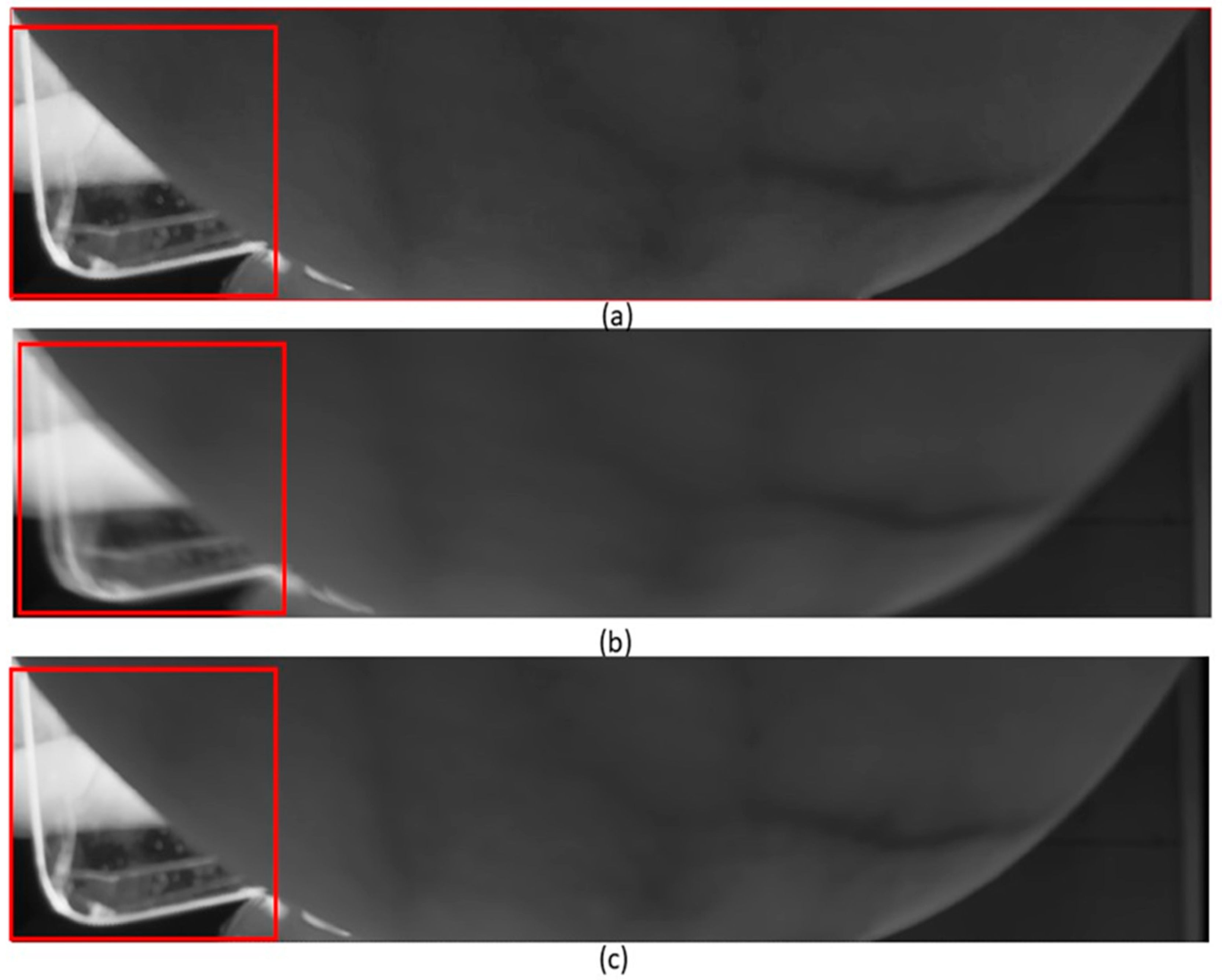 Bioengineering 11 01281 g012