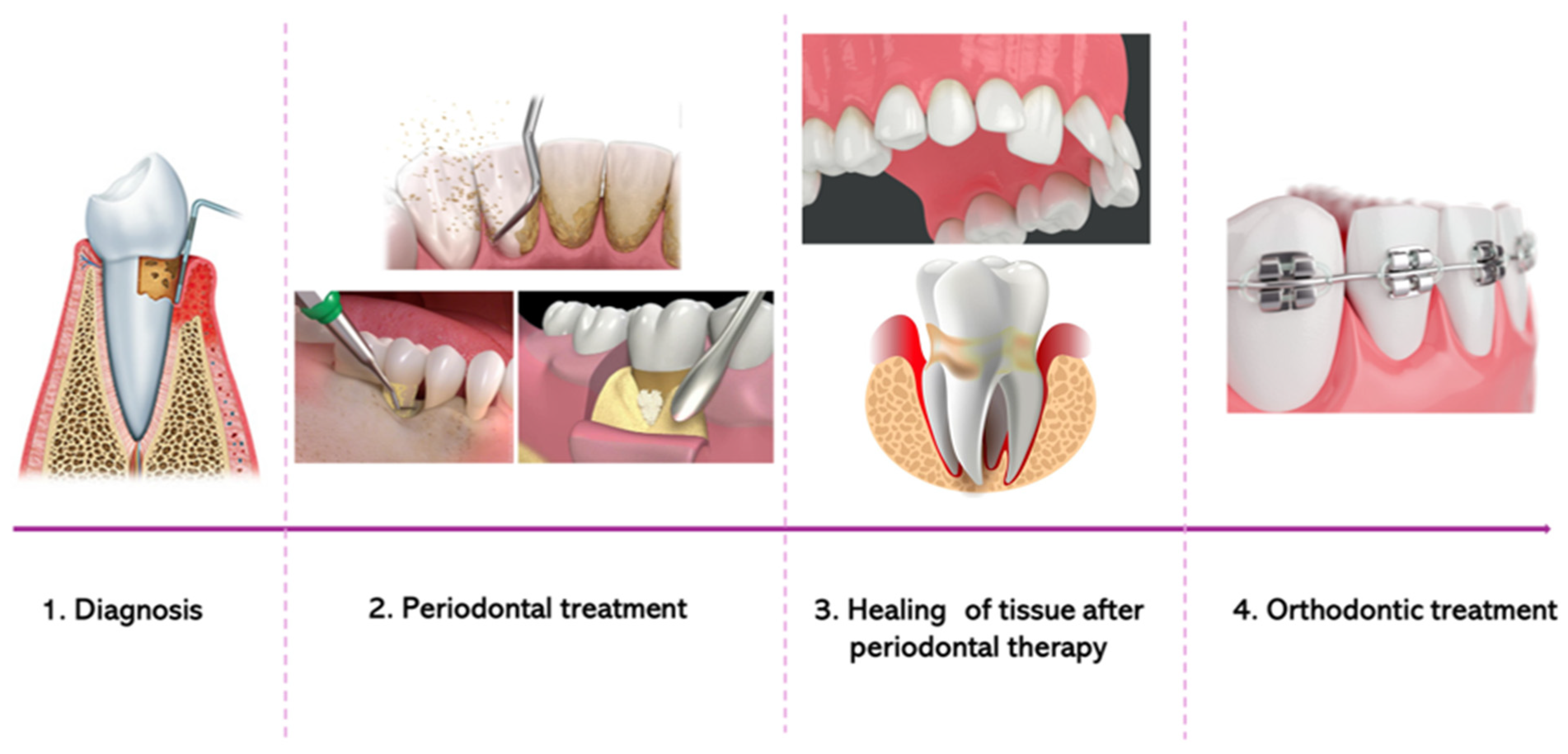 Bioengineering 12 00049 g002