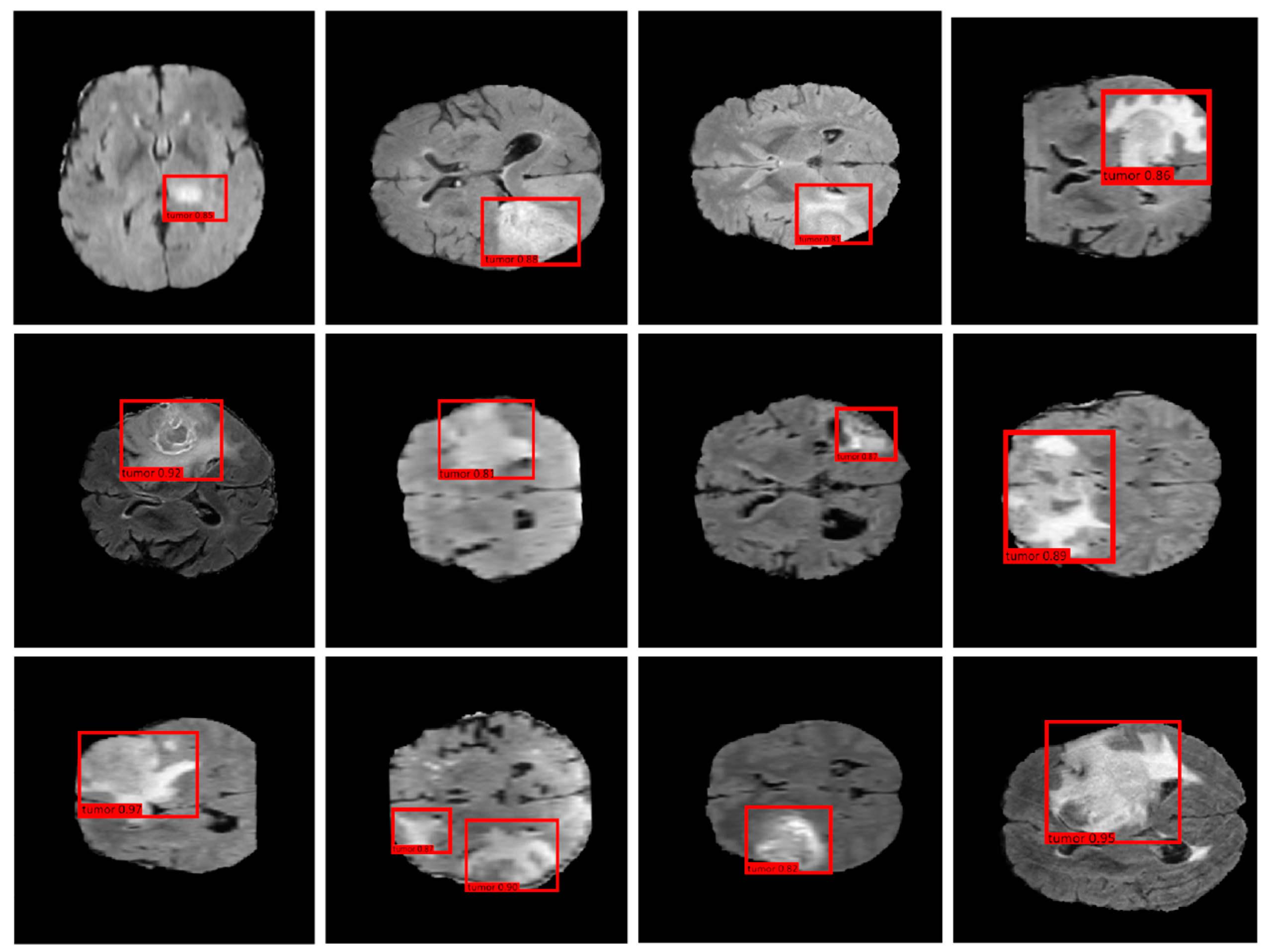 Accessible AI Diagnostics and Lightweight Brain Tumor Detection on ...