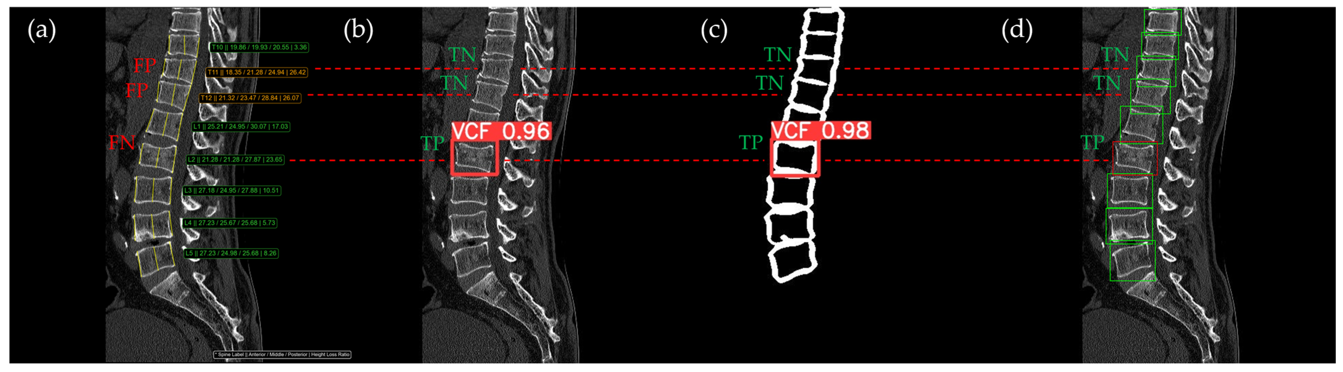 Bioengineering 12 00064 g011